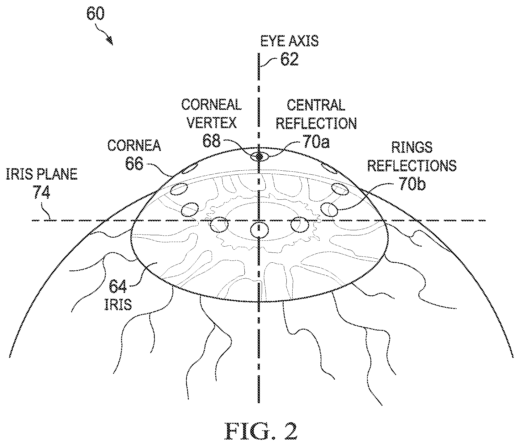Patent US12564515 Figure 2 – Docking an eye for ophthalmic laser treatment