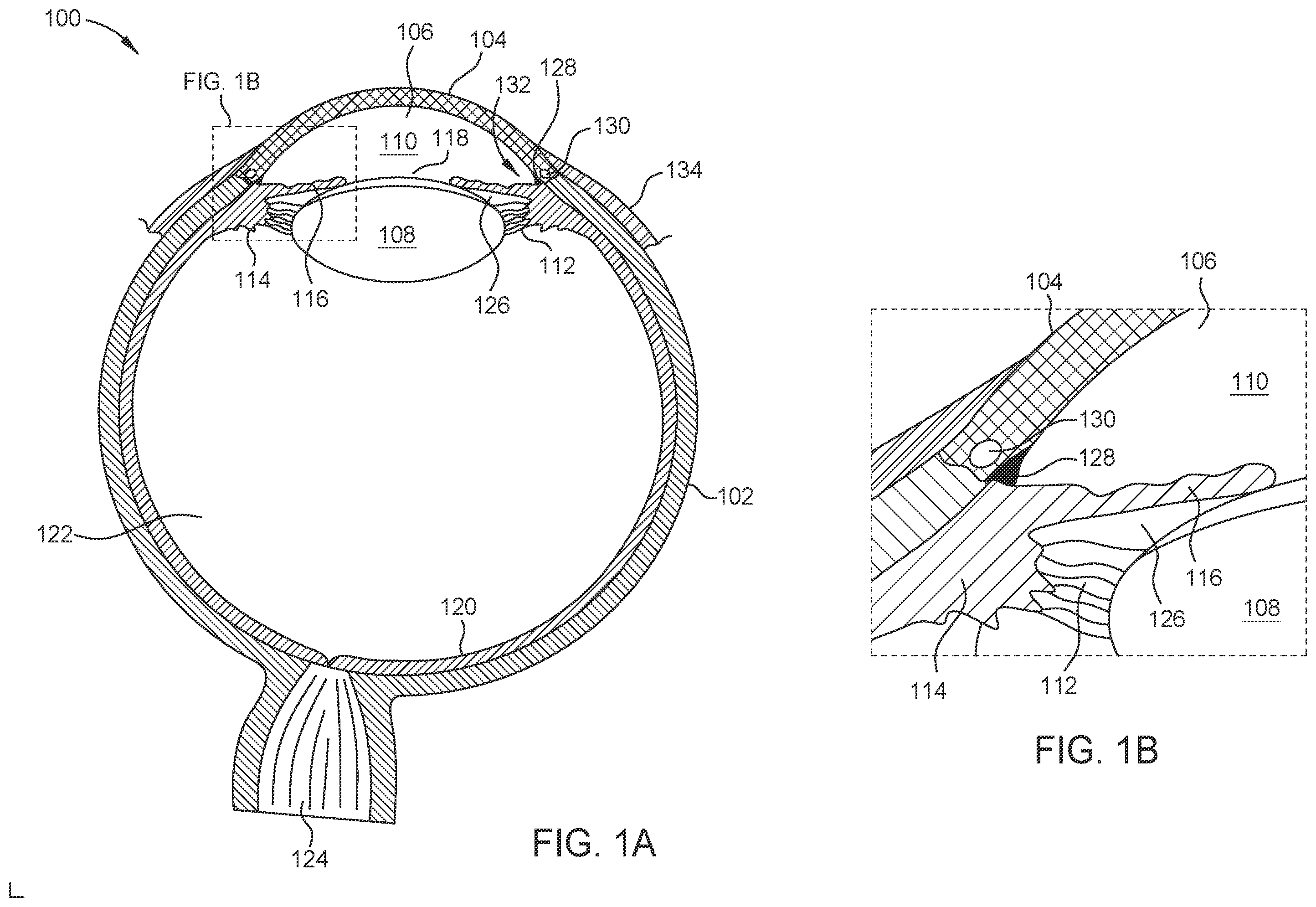 Patent US12564516 — Probe for laser ablation, illumination, and viscoelastic injection — Figure 1