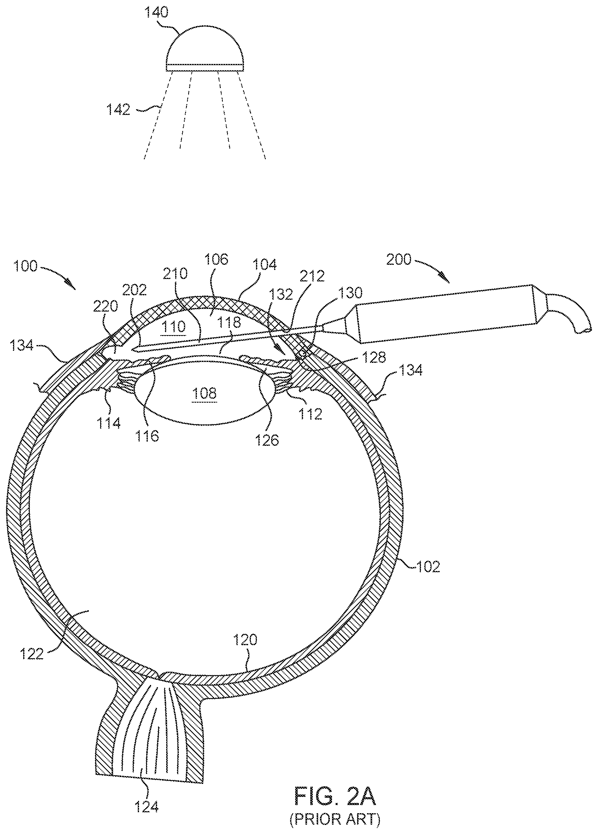 Patent US12564516 Figure 2 – Probe for laser ablation, illumination, and viscoelastic injection