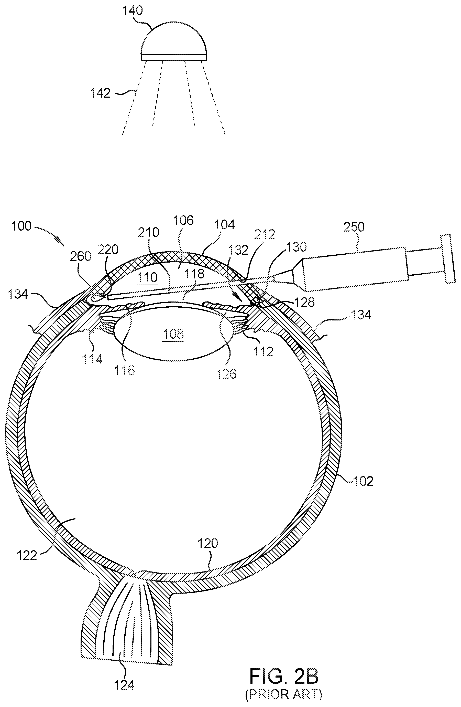 Patent US12564516 Figure 3 – Probe for laser ablation, illumination, and viscoelastic injection