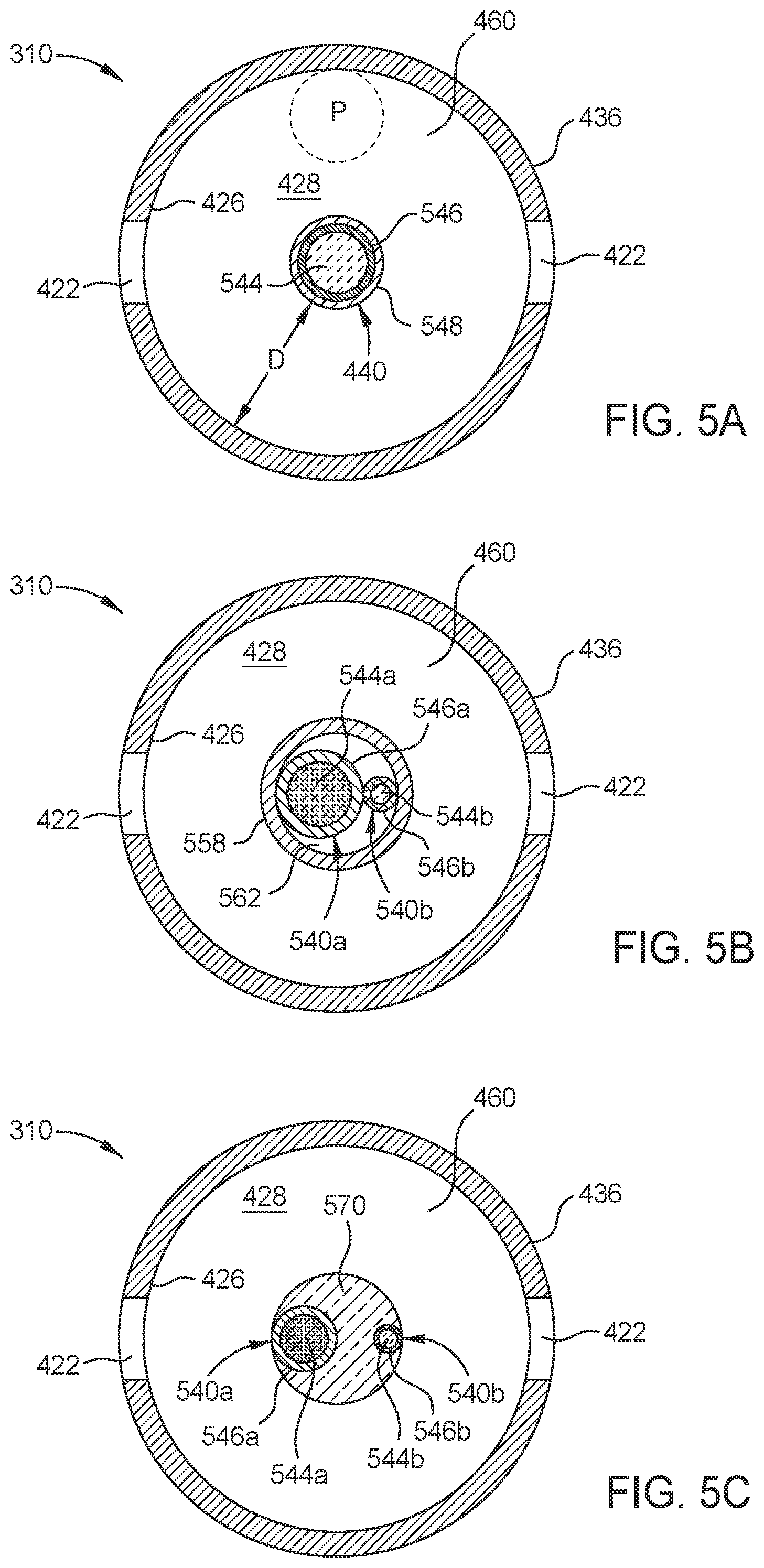 Patent US12564516 Figure 6 – Probe for laser ablation, illumination, and viscoelastic injection