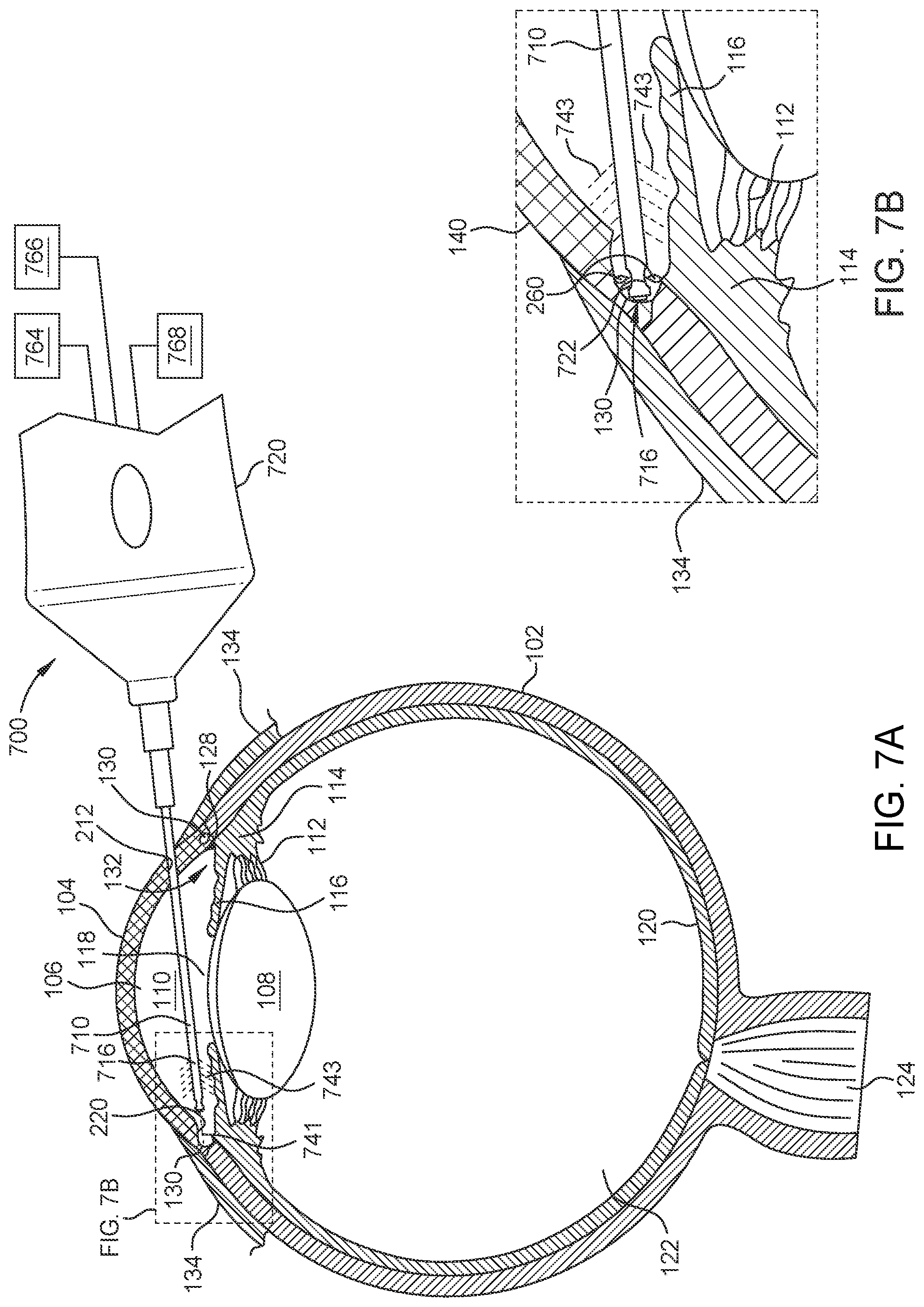 Patent US12564516 Figure 9 – Probe for laser ablation, illumination, and viscoelastic injection
