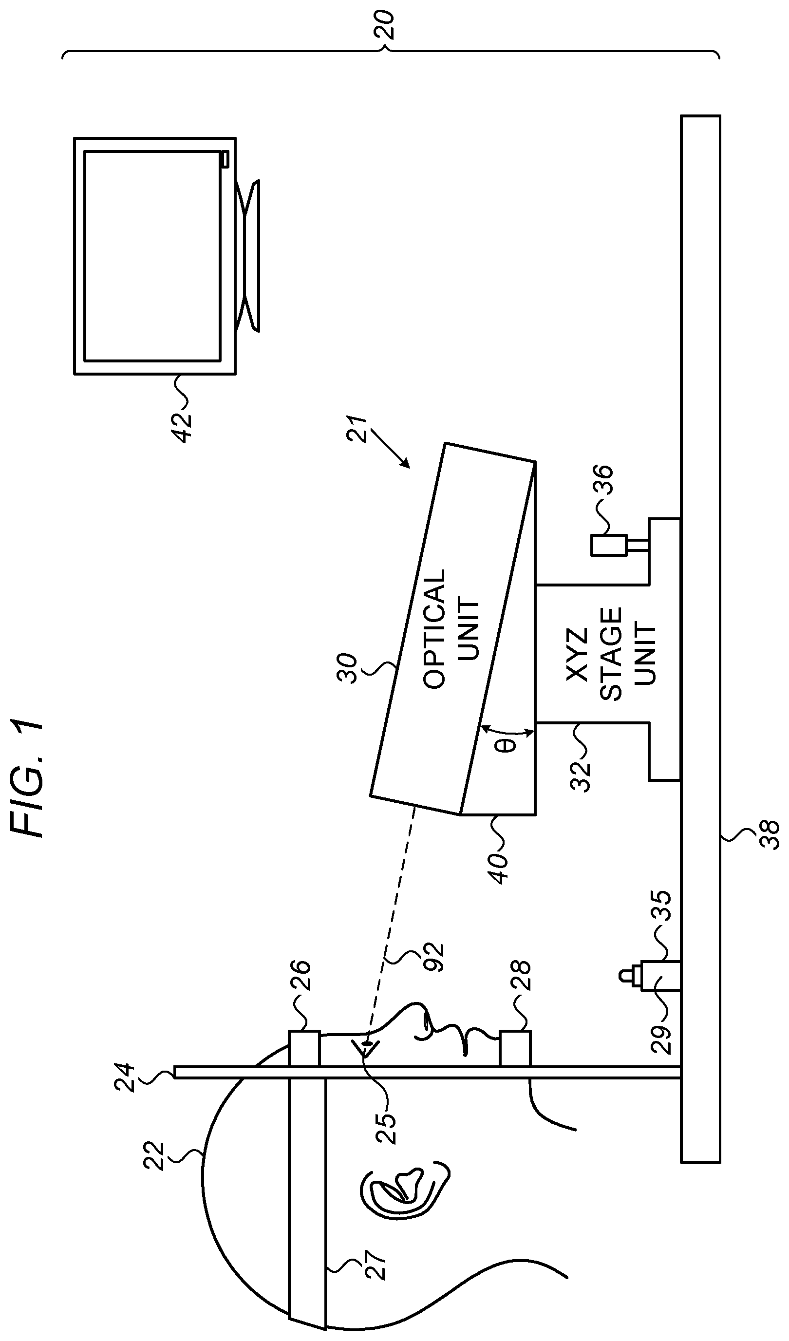 Patent US12564517 Figure 1 – Avoiding blood vessels during direct selective laser trabeculoplasty