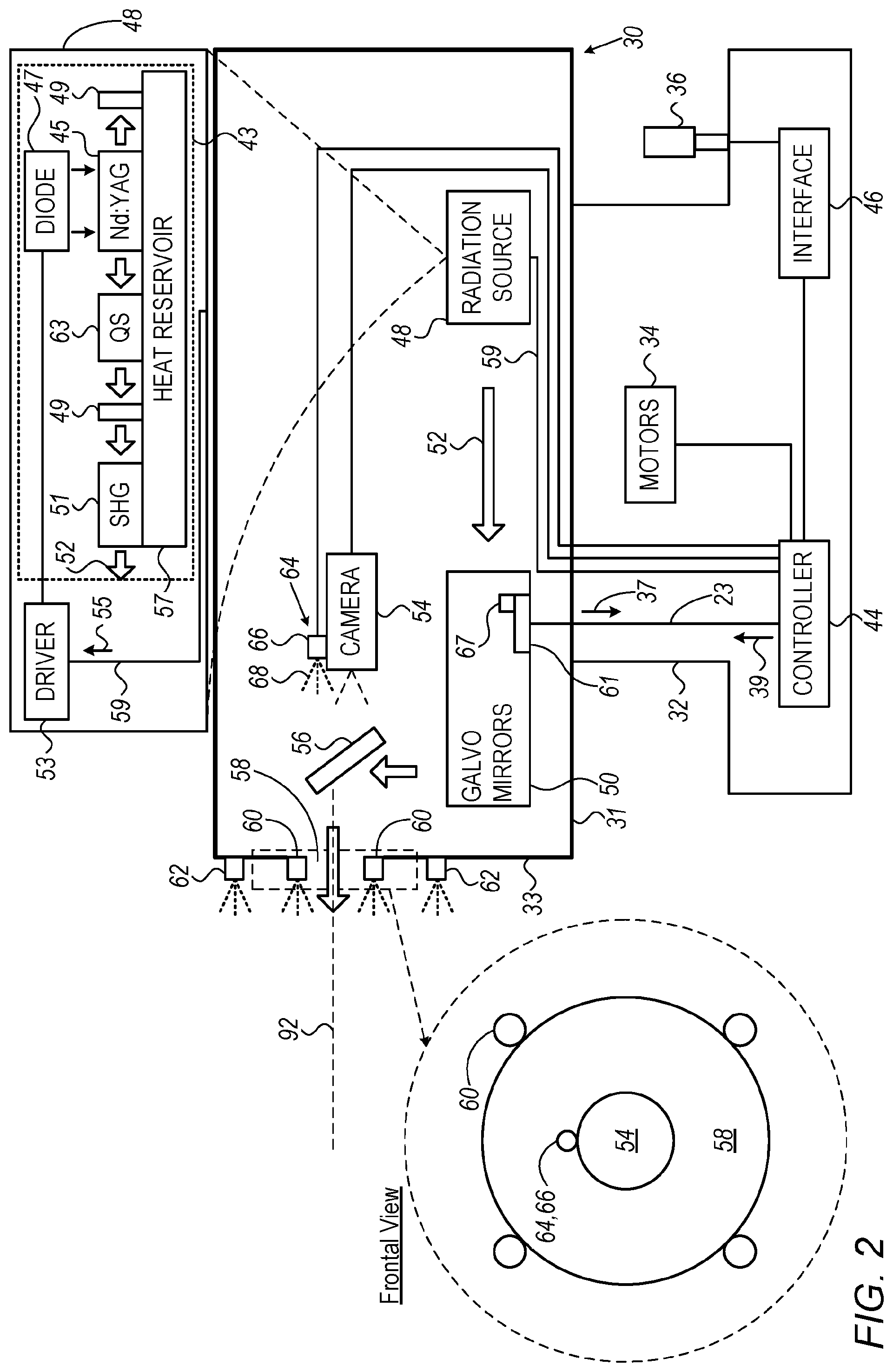 Patent US12564517 Figure 2 – Avoiding blood vessels during direct selective laser trabeculoplasty
