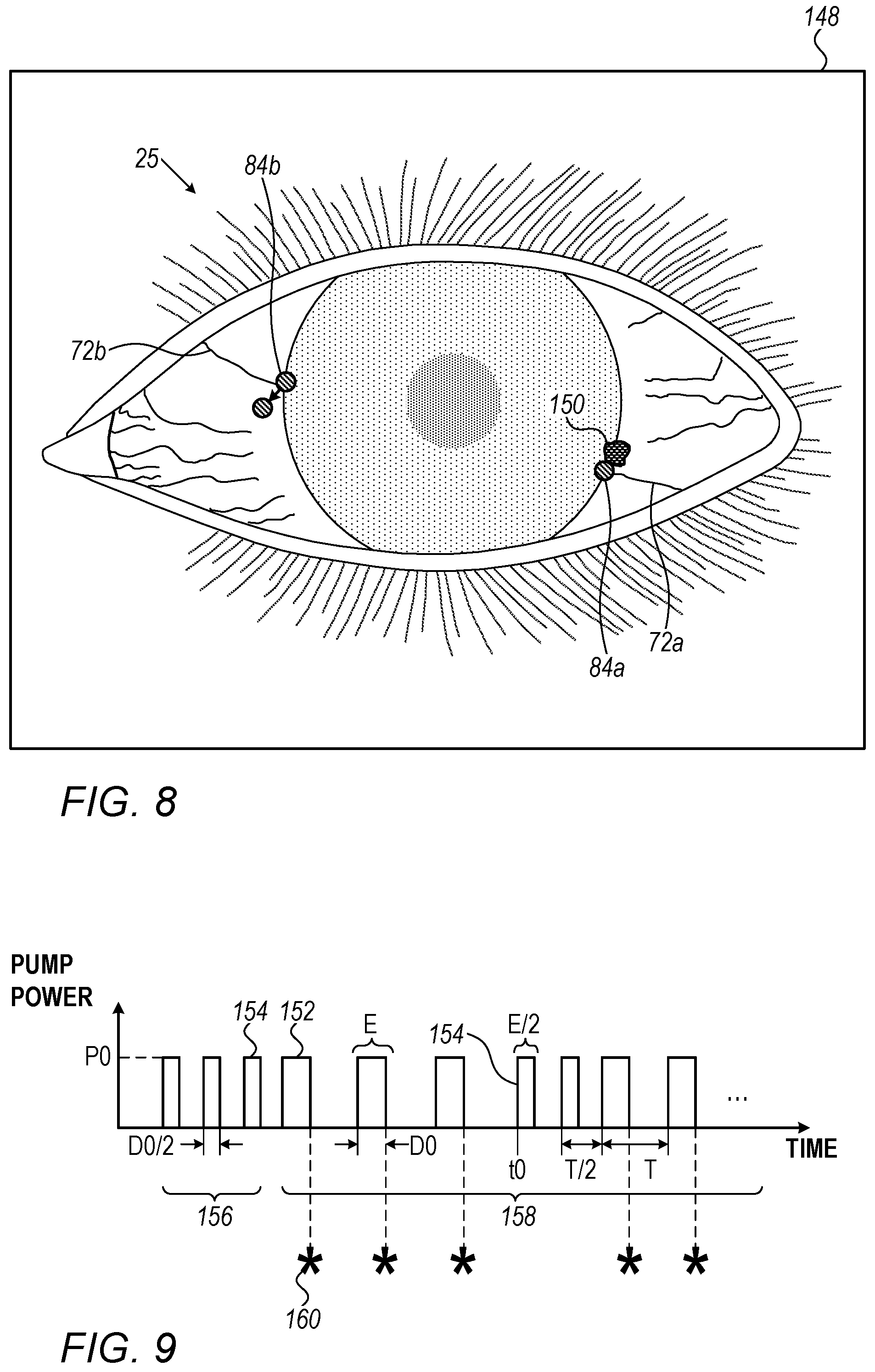 Patent US12564517 Figure 9 – Avoiding blood vessels during direct selective laser trabeculoplasty