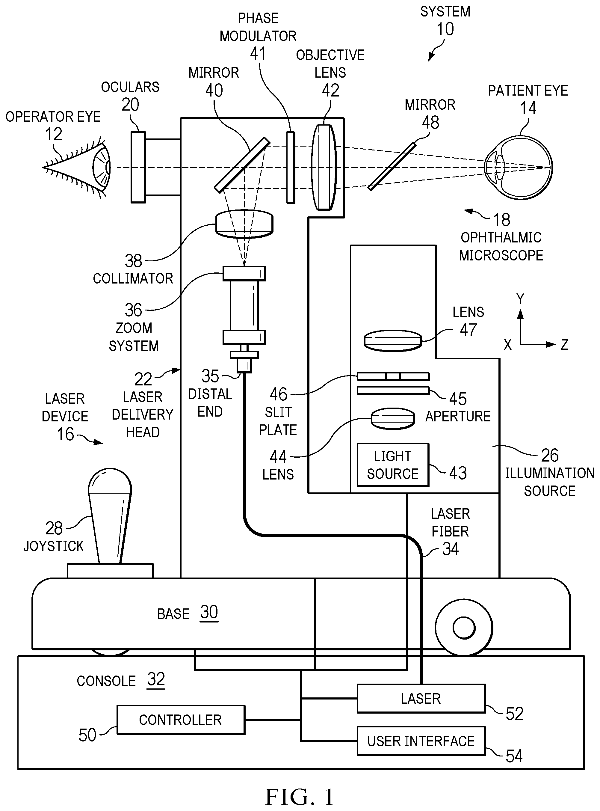 Patent US12564518 Figure 1 – Performing laser vitreolysis on an eye with an intraocular lens