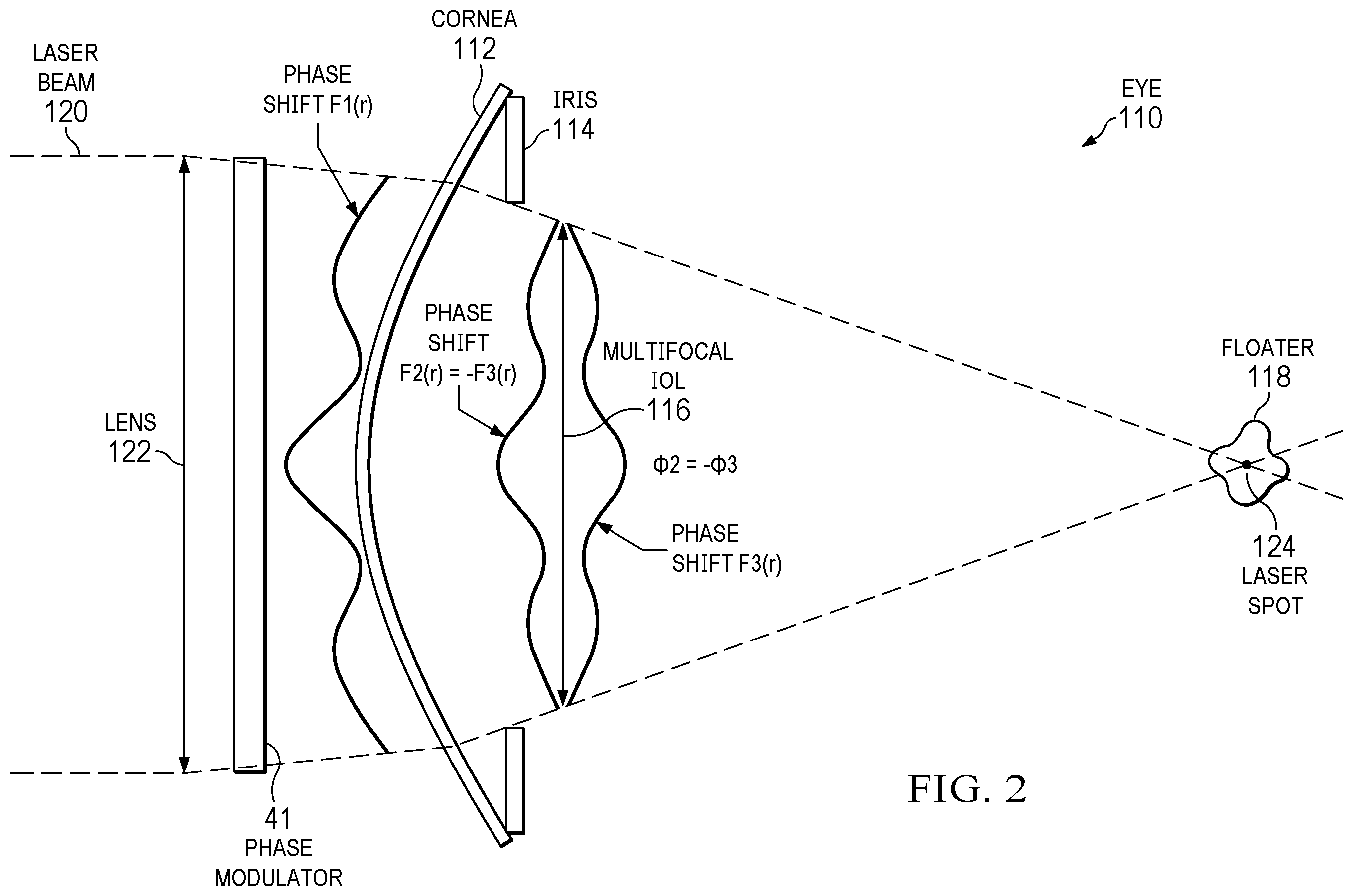 Patent US12564518 Figure 2 – Performing laser vitreolysis on an eye with an intraocular lens