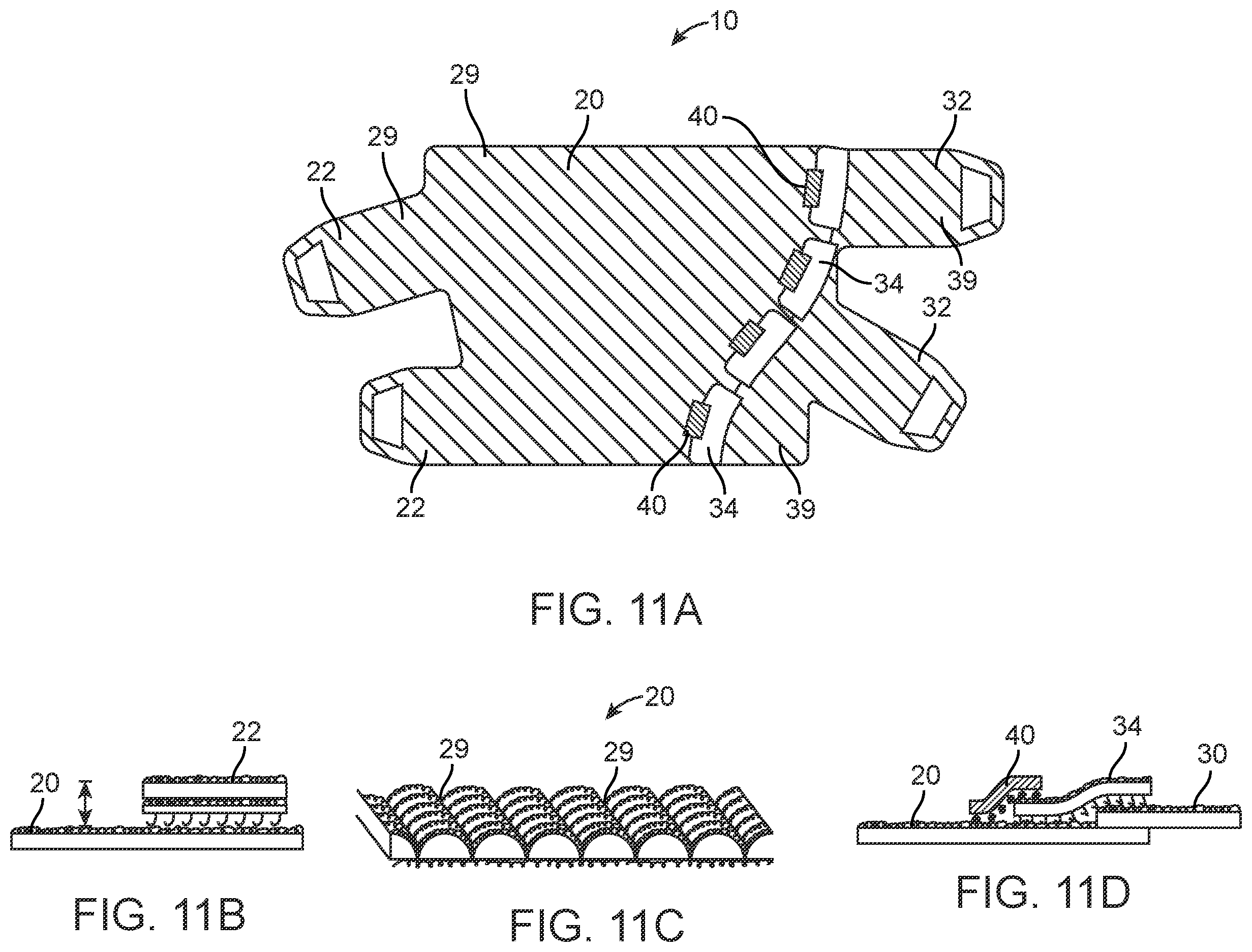 Patent US12564520 Figure 13 – Graduated compression device for the treatment of circulatory disorders