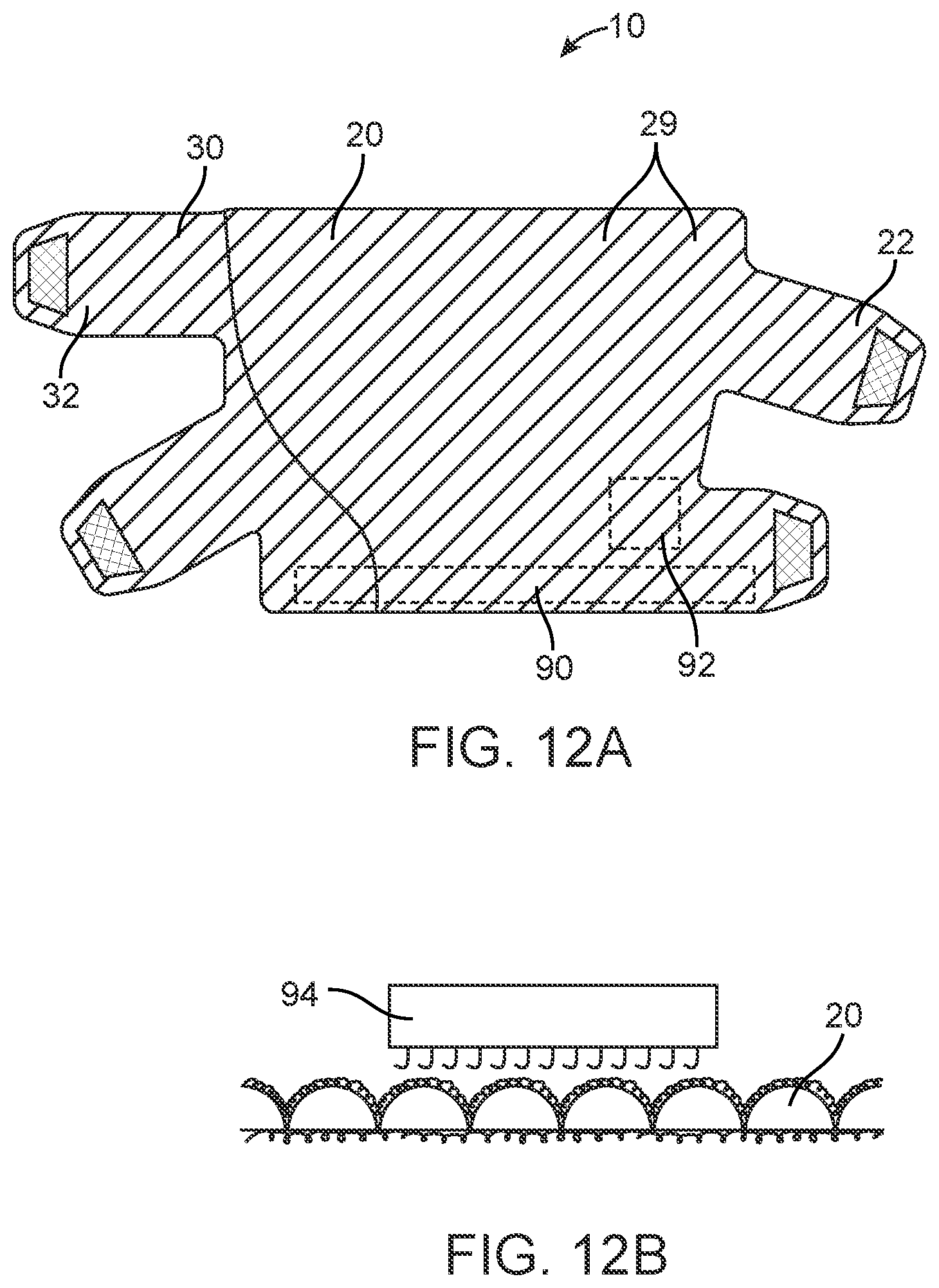 Patent US12564520 Figure 14 – Graduated compression device for the treatment of circulatory disorders