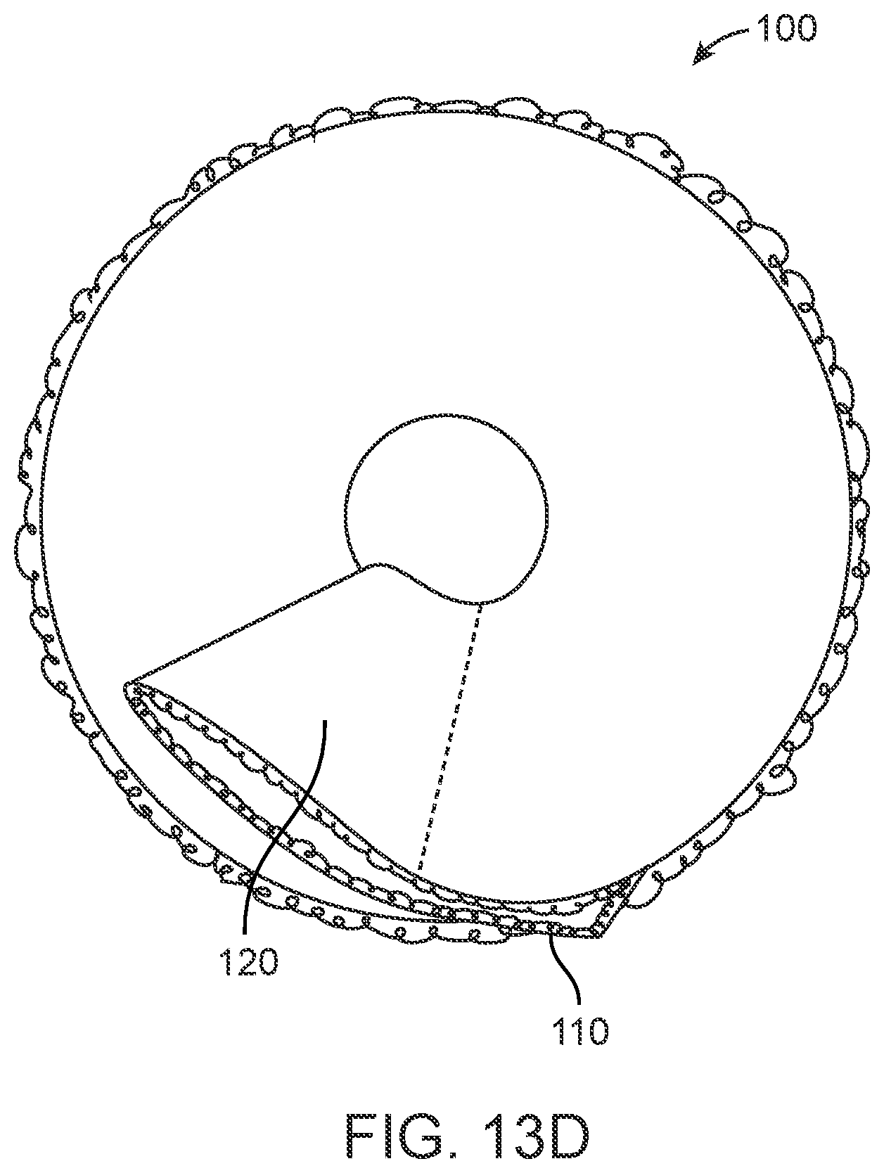 Patent US12564520 Figure 17 – Graduated compression device for the treatment of circulatory disorders