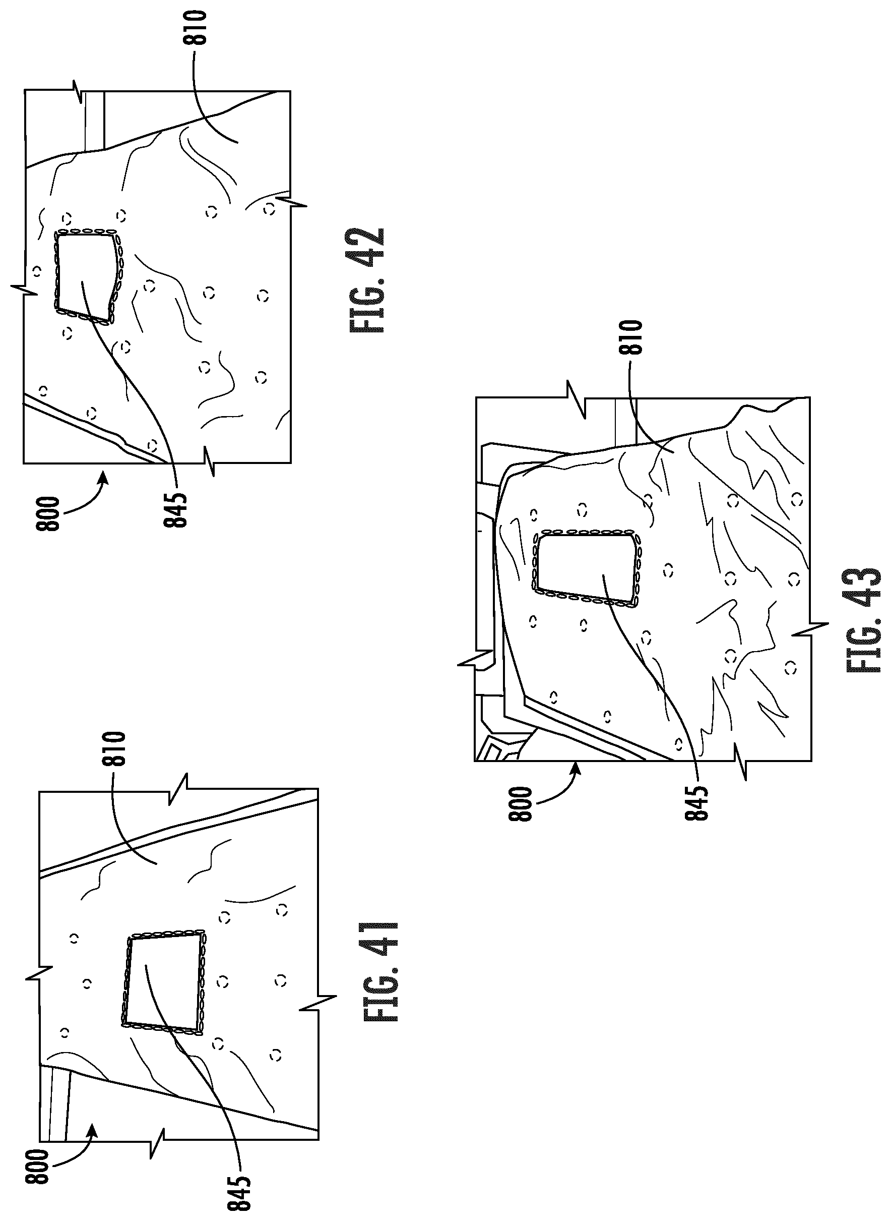 Patent US12564529 Figure 19 – Patient transfer device