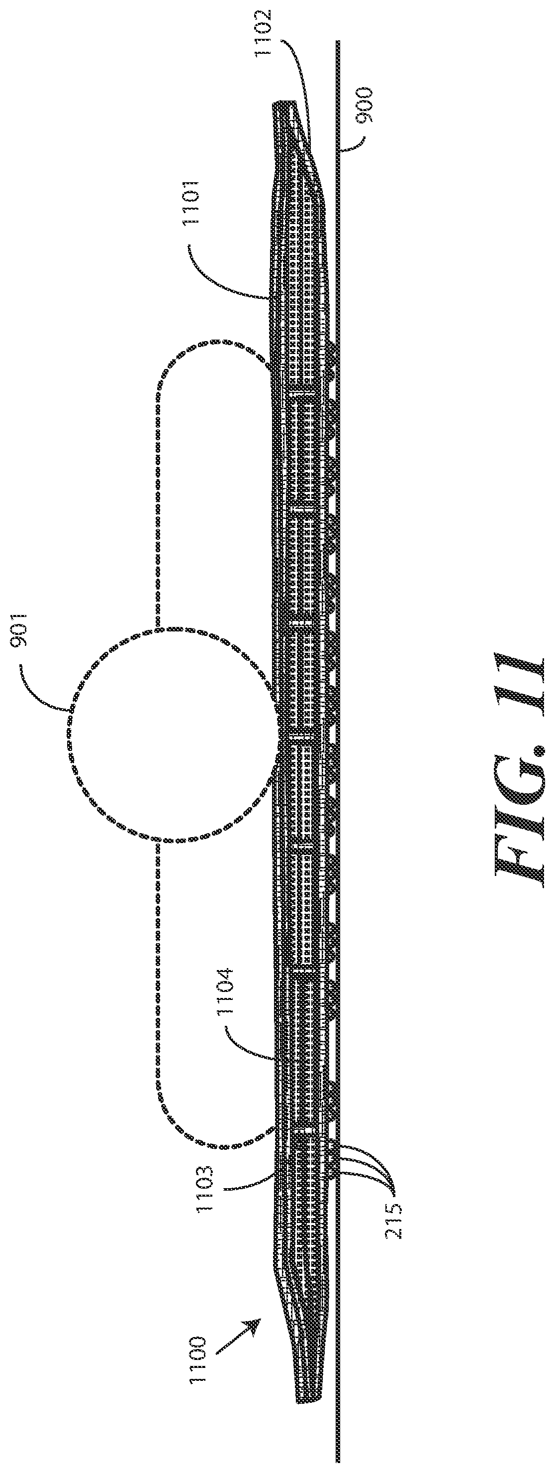 Patent US12564530 Figure 11 – Inflatable patient positioner with selectively engaging surface gripping zones