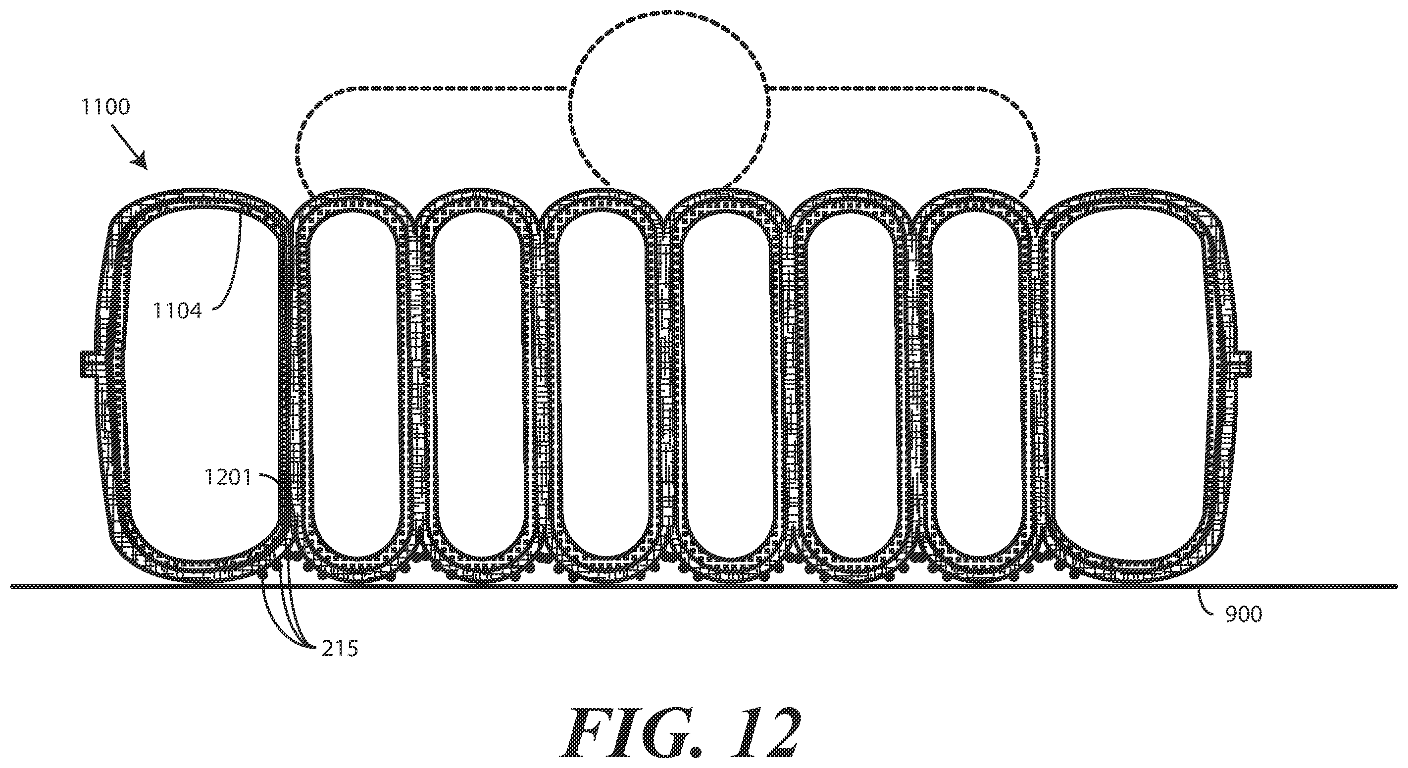 Patent US12564530 Figure 12 – Inflatable patient positioner with selectively engaging surface gripping zones