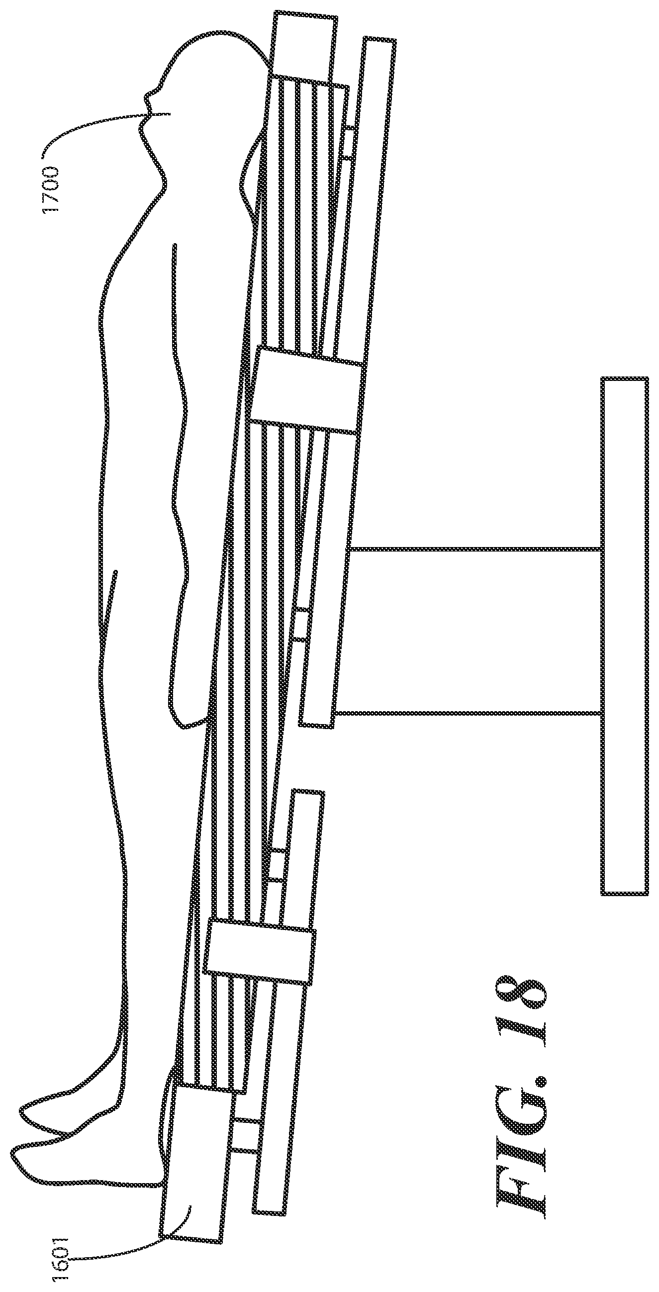 Patent US12564530 Figure 17 – Inflatable patient positioner with selectively engaging surface gripping zones