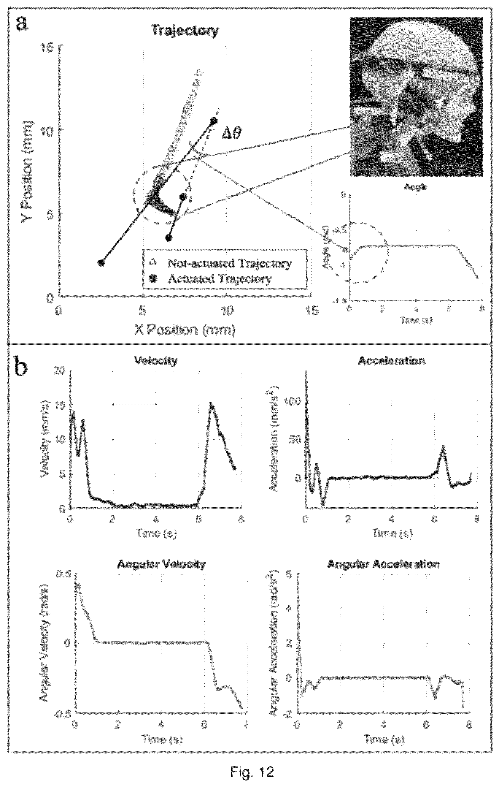 Patent US12564531 Figure 14 – Soft exoskeleton wearable device for temporomandibular disorder (TMD) rehabilitation