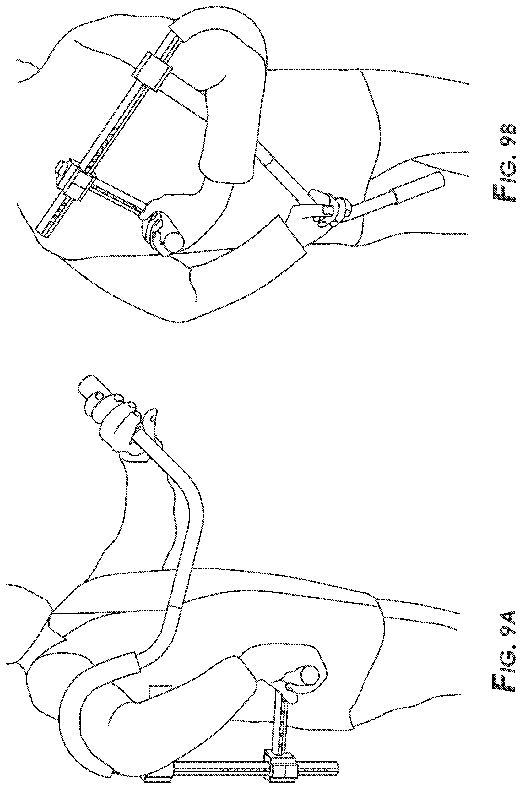 Patent US12564532 Figure 11 – Adjustable, multi-functional shoulder stretching device
