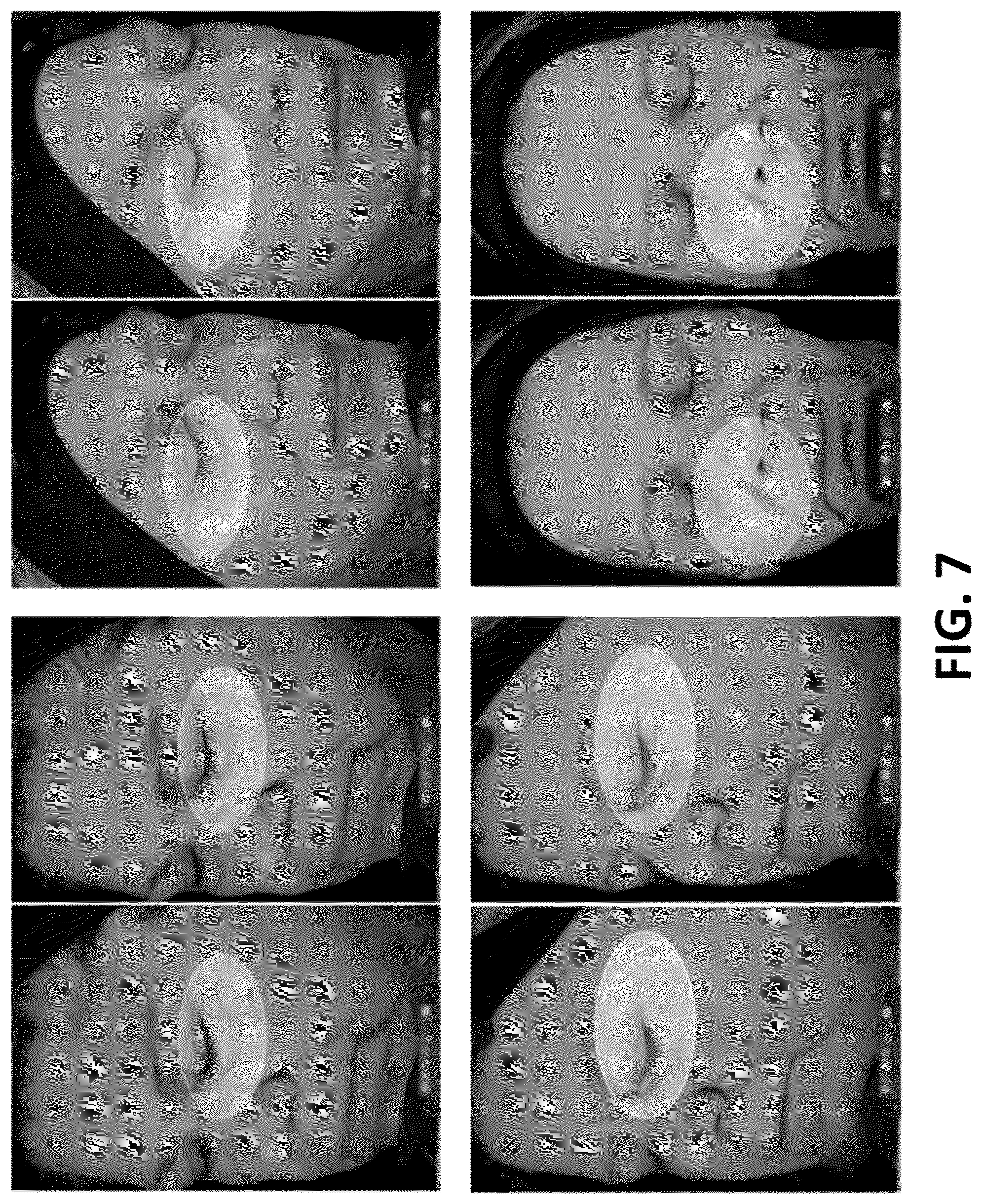 Patent US12564547 Figure 15 – Compositions, formulations, and methods for skin treatment