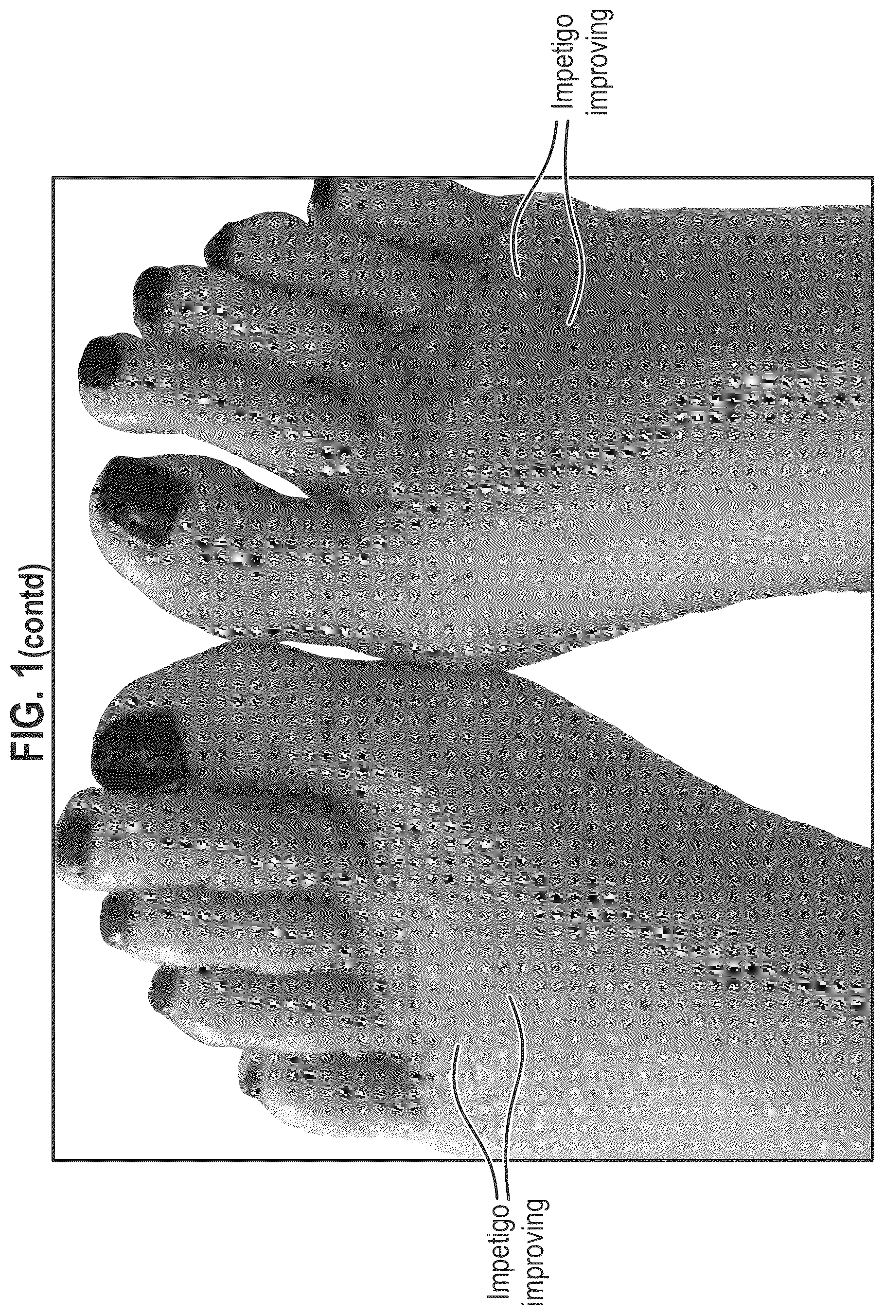 Patent US12564563 Figure 2 – Composition and methods for treating pathogenic infections on wounds