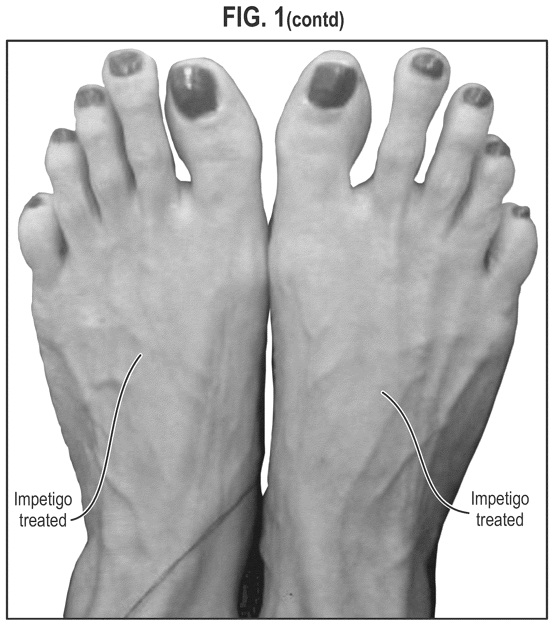 Patent US12564563 Figure 3 – Composition and methods for treating pathogenic infections on wounds