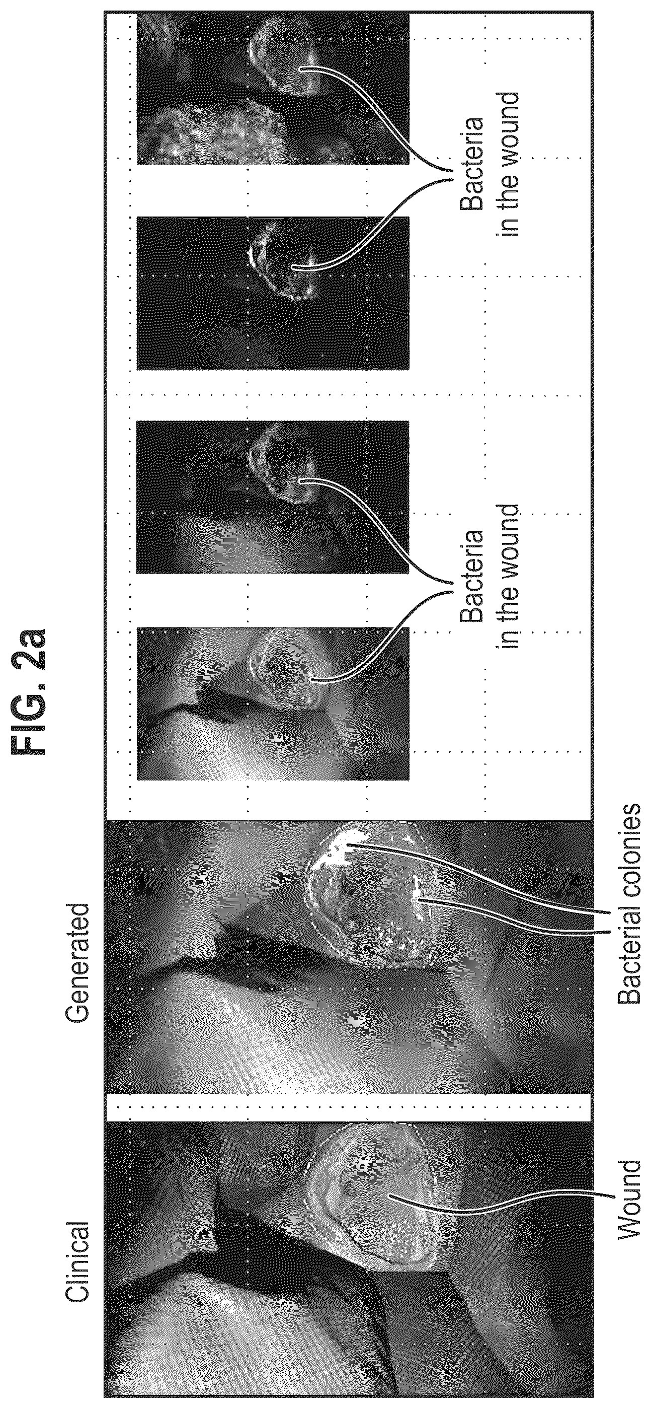 Patent US12564563 Figure 4 – Composition and methods for treating pathogenic infections on wounds