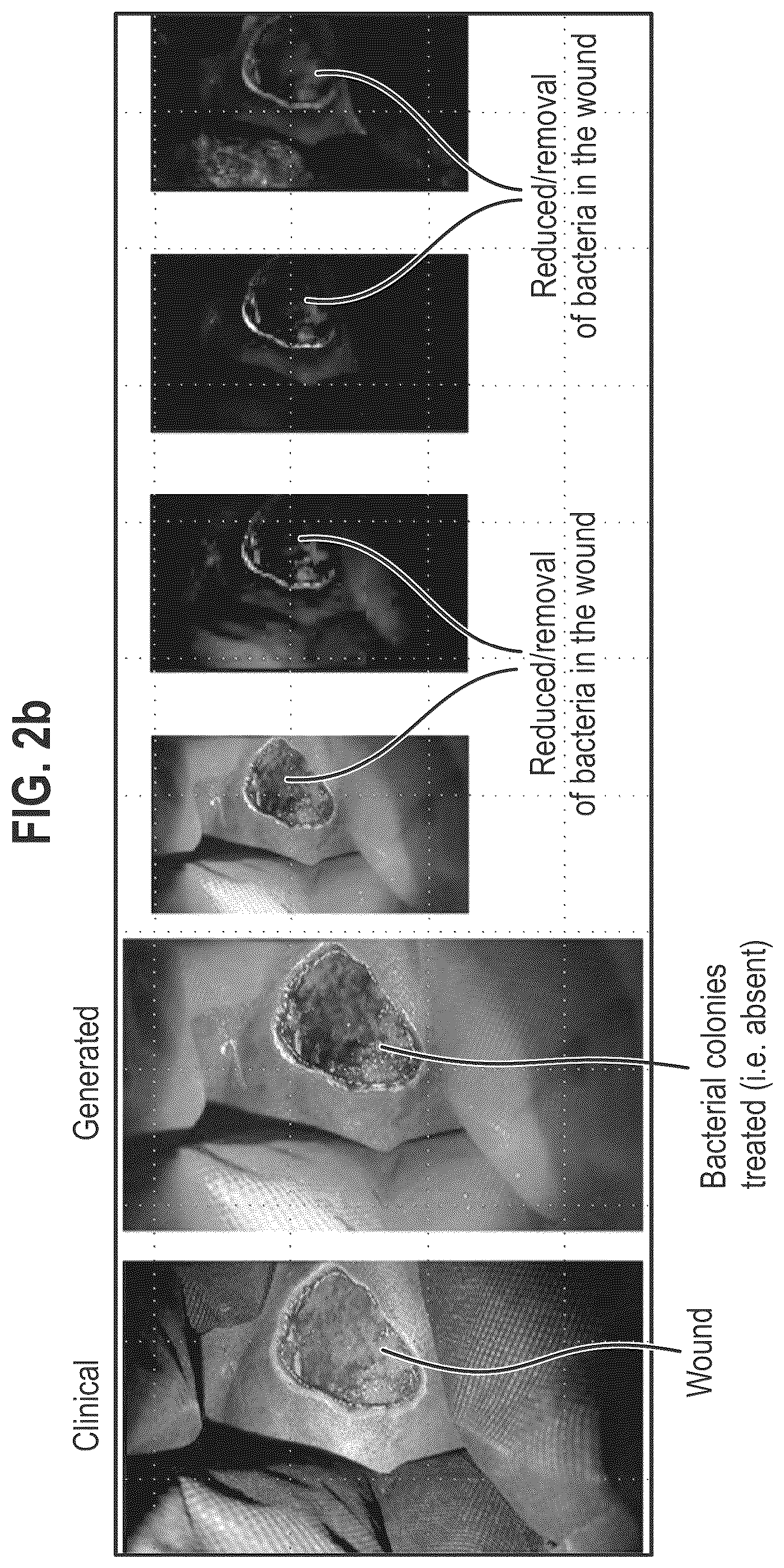 Patent US12564563 Figure 5 – Composition and methods for treating pathogenic infections on wounds