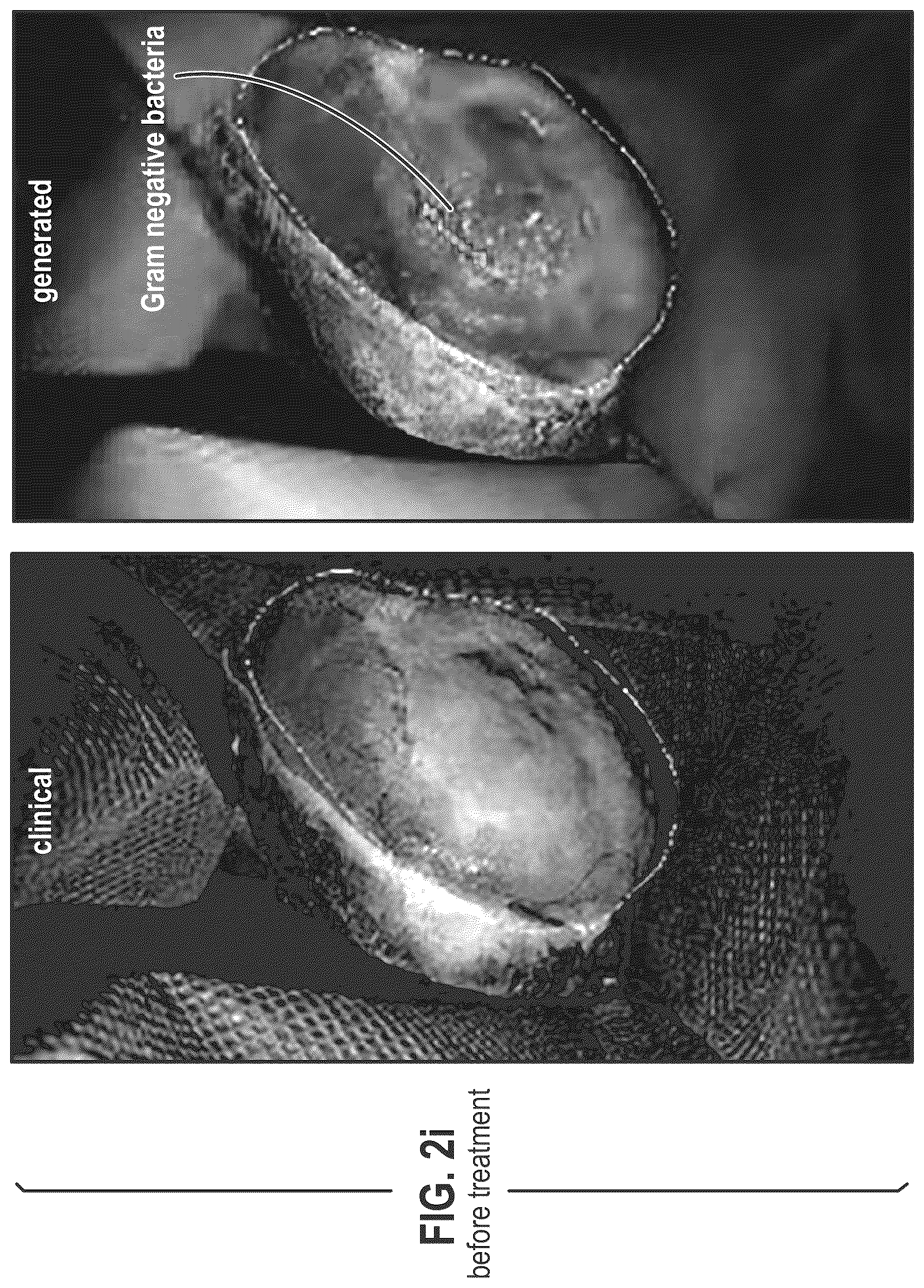 Patent US12564563 Figure 12 – Composition and methods for treating pathogenic infections on wounds