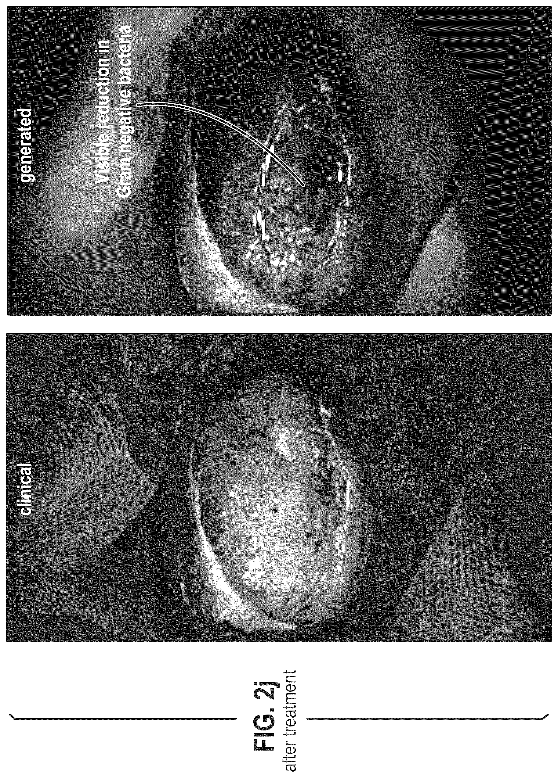 Patent US12564563 Figure 13 – Composition and methods for treating pathogenic infections on wounds