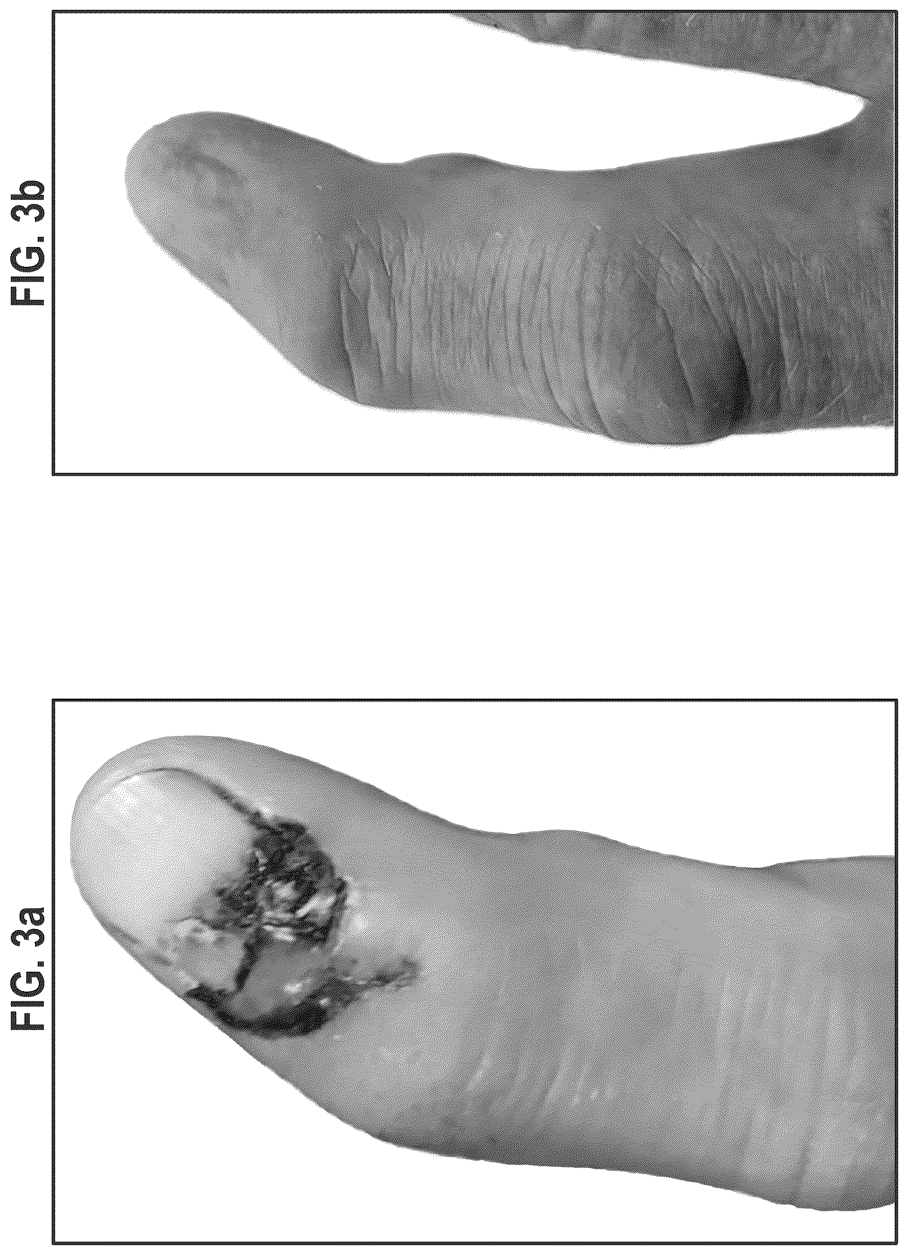 Patent US12564563 Figure 14 – Composition and methods for treating pathogenic infections on wounds