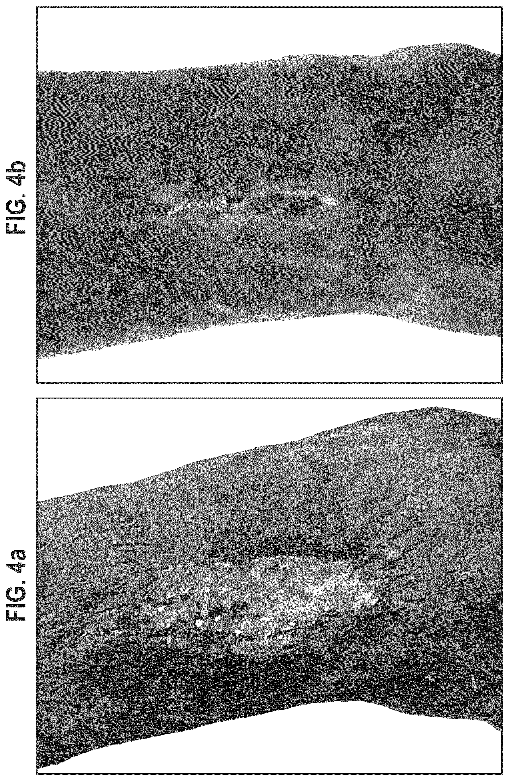 Patent US12564563 Figure 15 – Composition and methods for treating pathogenic infections on wounds