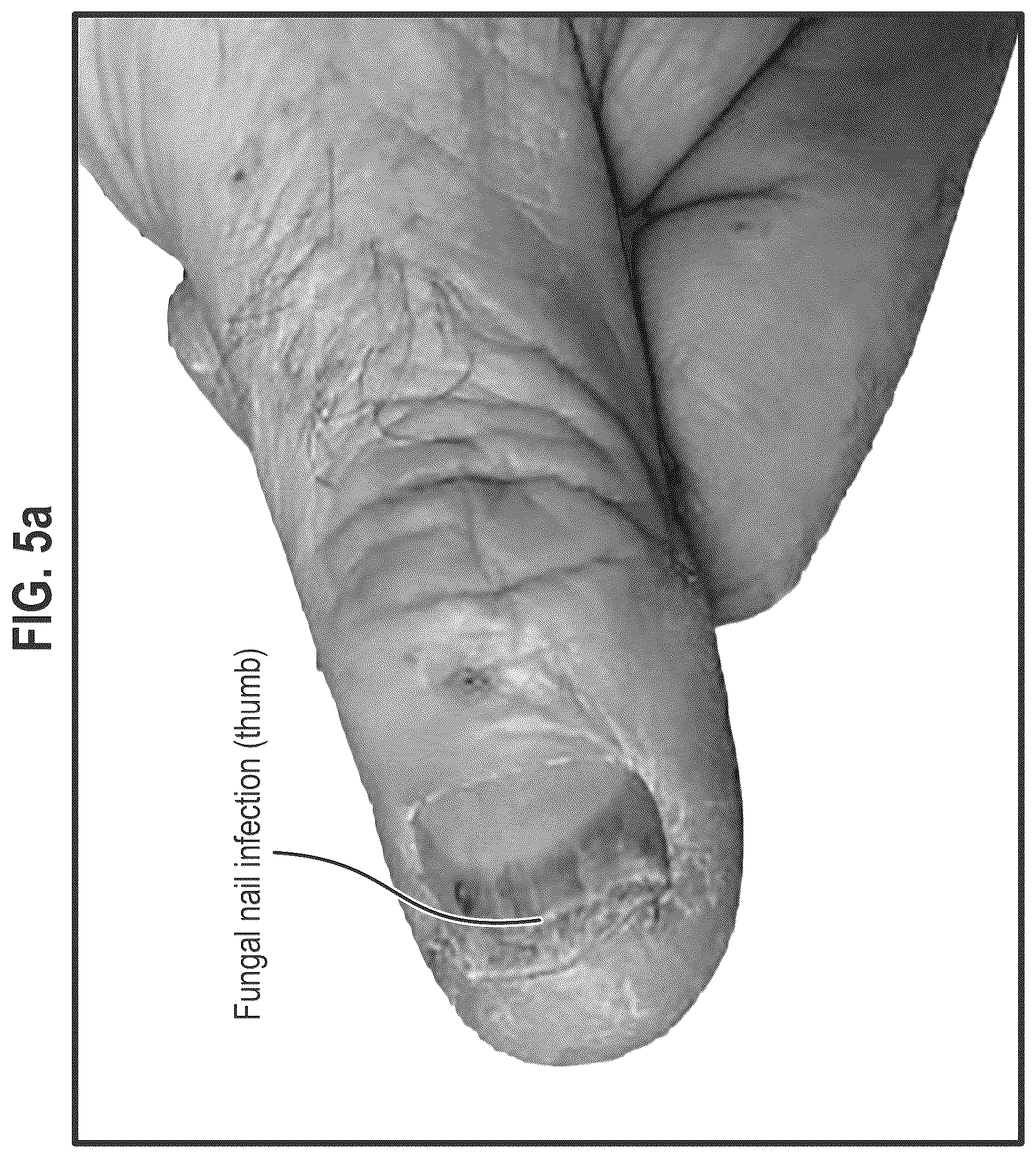 Patent US12564563 Figure 16 – Composition and methods for treating pathogenic infections on wounds