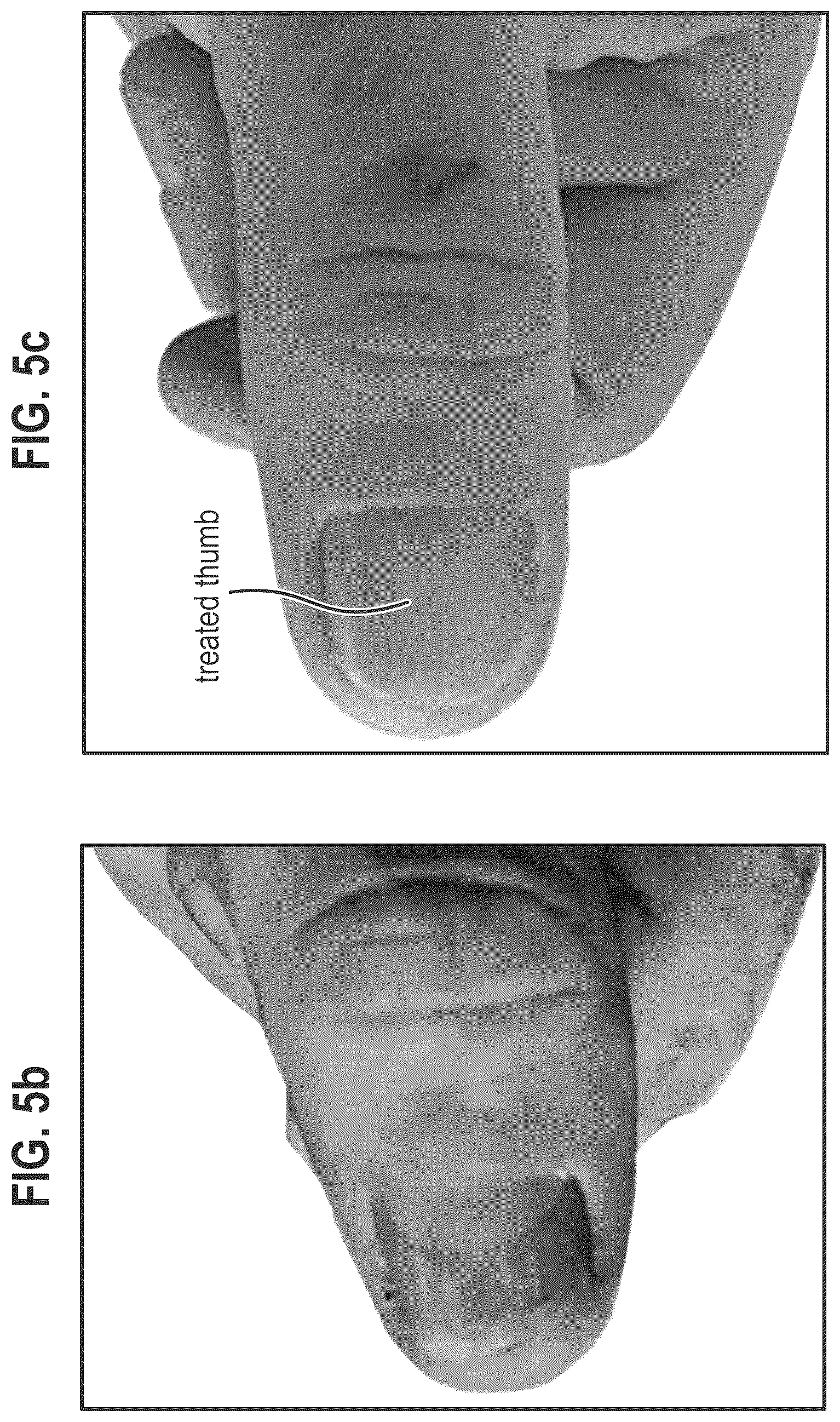 Patent US12564563 Figure 17 – Composition and methods for treating pathogenic infections on wounds