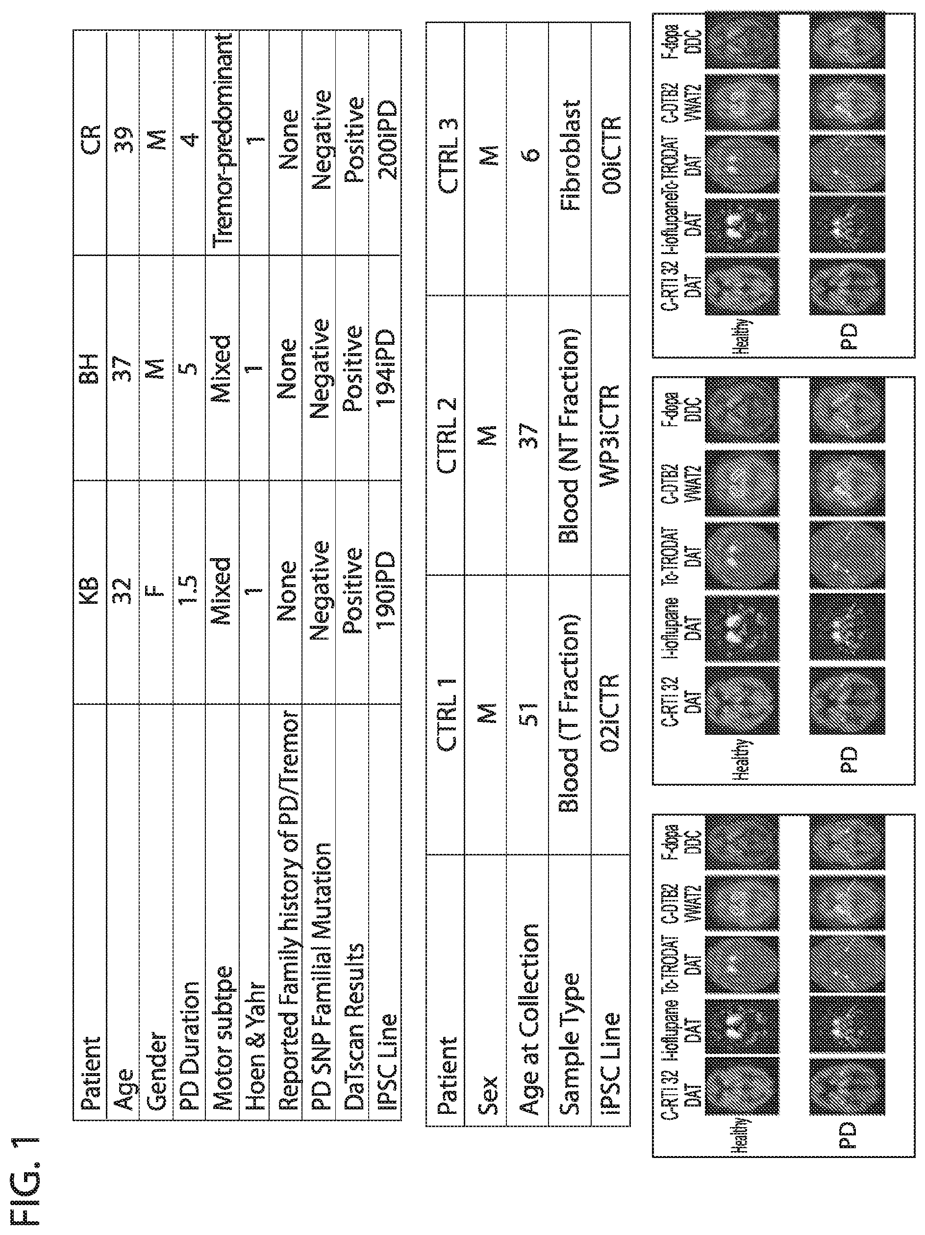 Patent US12564568 Figure 1 – PKC pathway in Parkinson's Disease