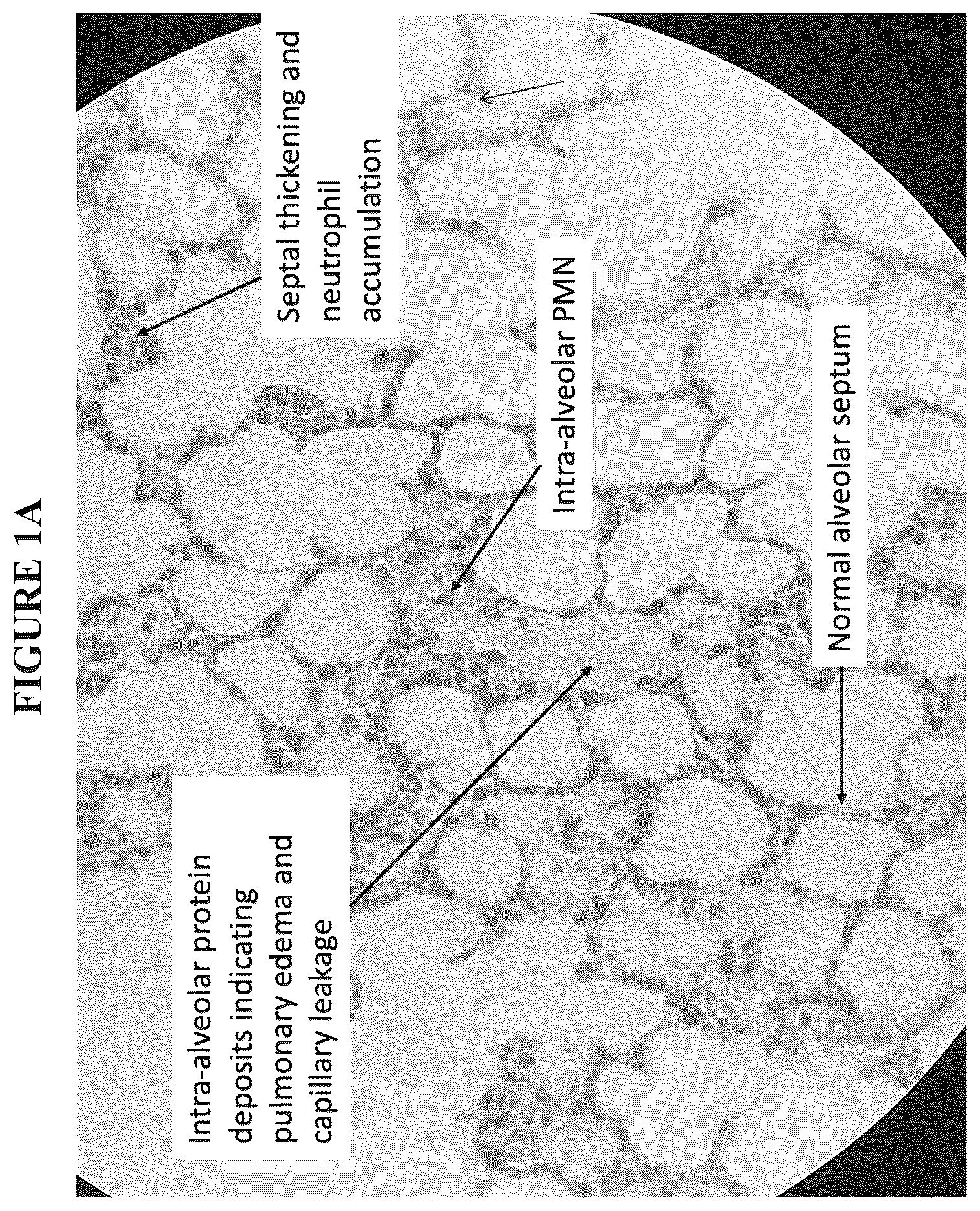 Patent US12564575 Figure 2 – Early management, mitigation and prevention of sepsis and sepsis-like syndromes, including neo-natal ARDS due to infection, injury or iatrogenesis
