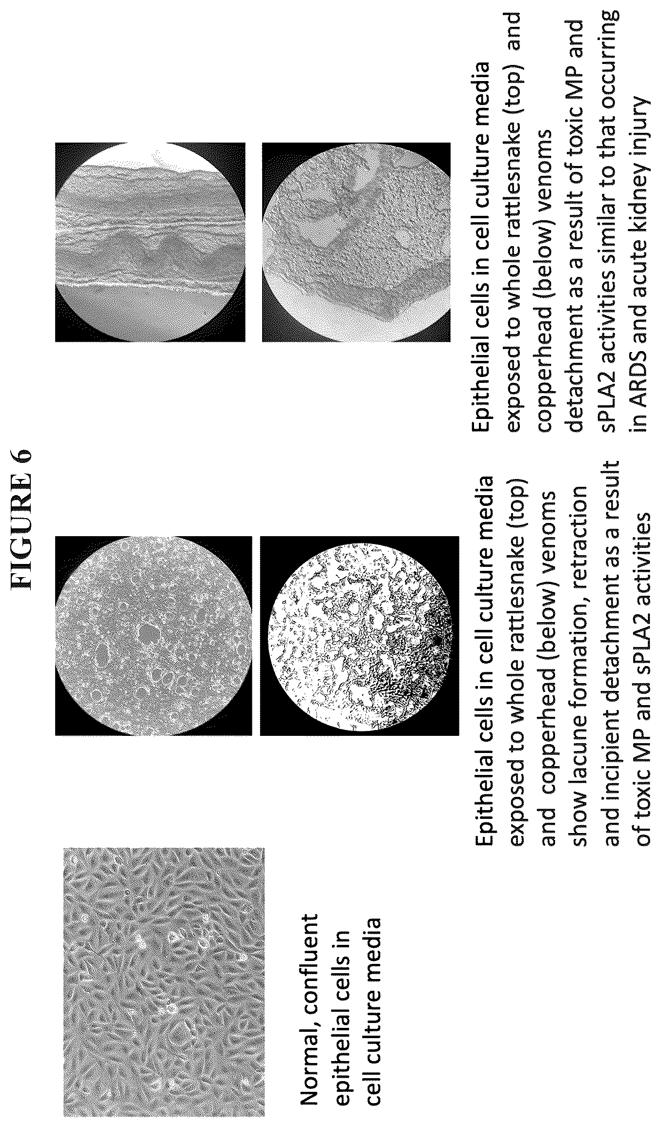 Patent US12564575 Figure 8 – Early management, mitigation and prevention of sepsis and sepsis-like syndromes, including neo-natal ARDS due to infection, injury or iatrogenesis
