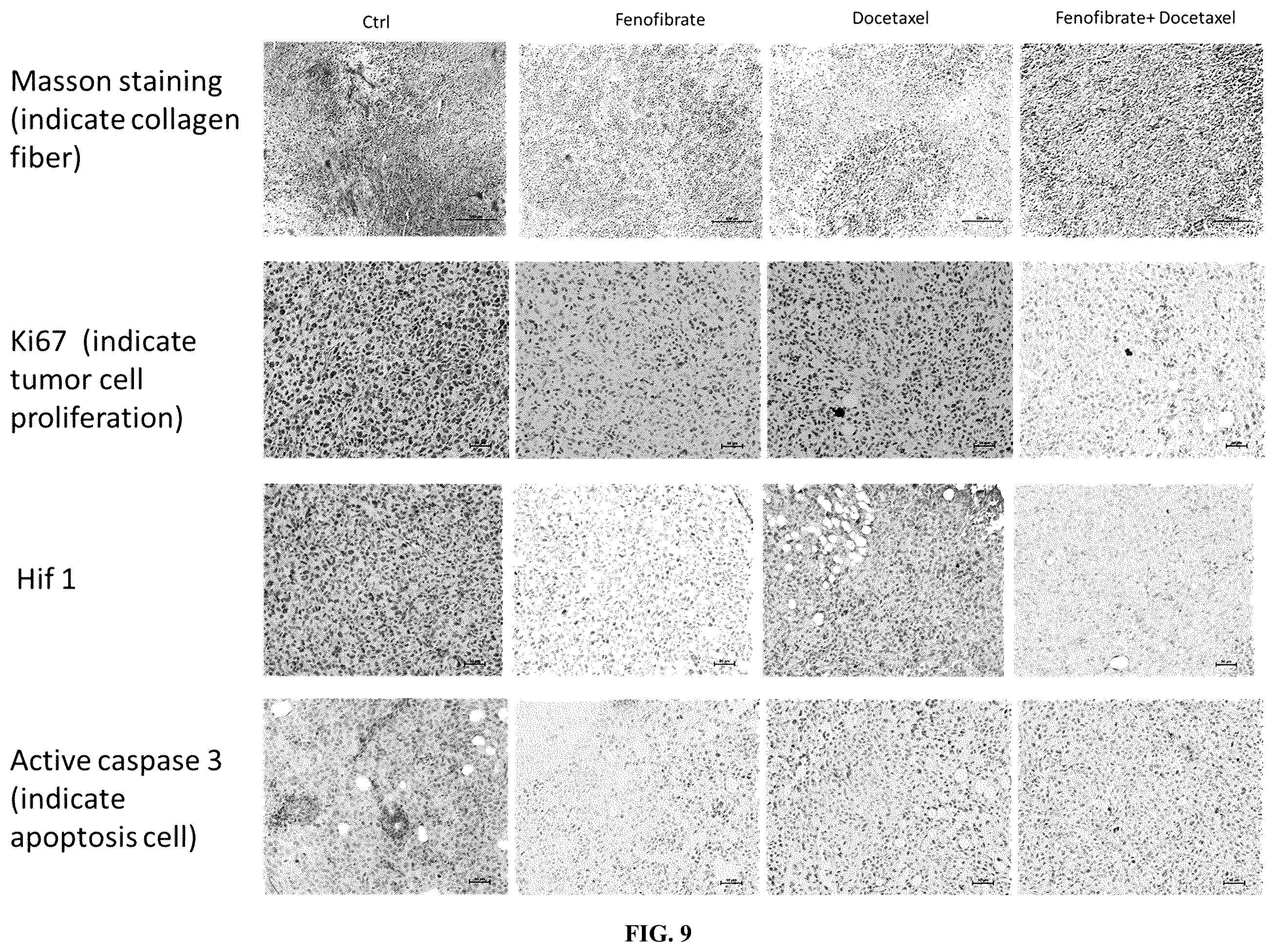 Patent US12564578 Figure 19 – Collagen P4H1 inhibitor and its use