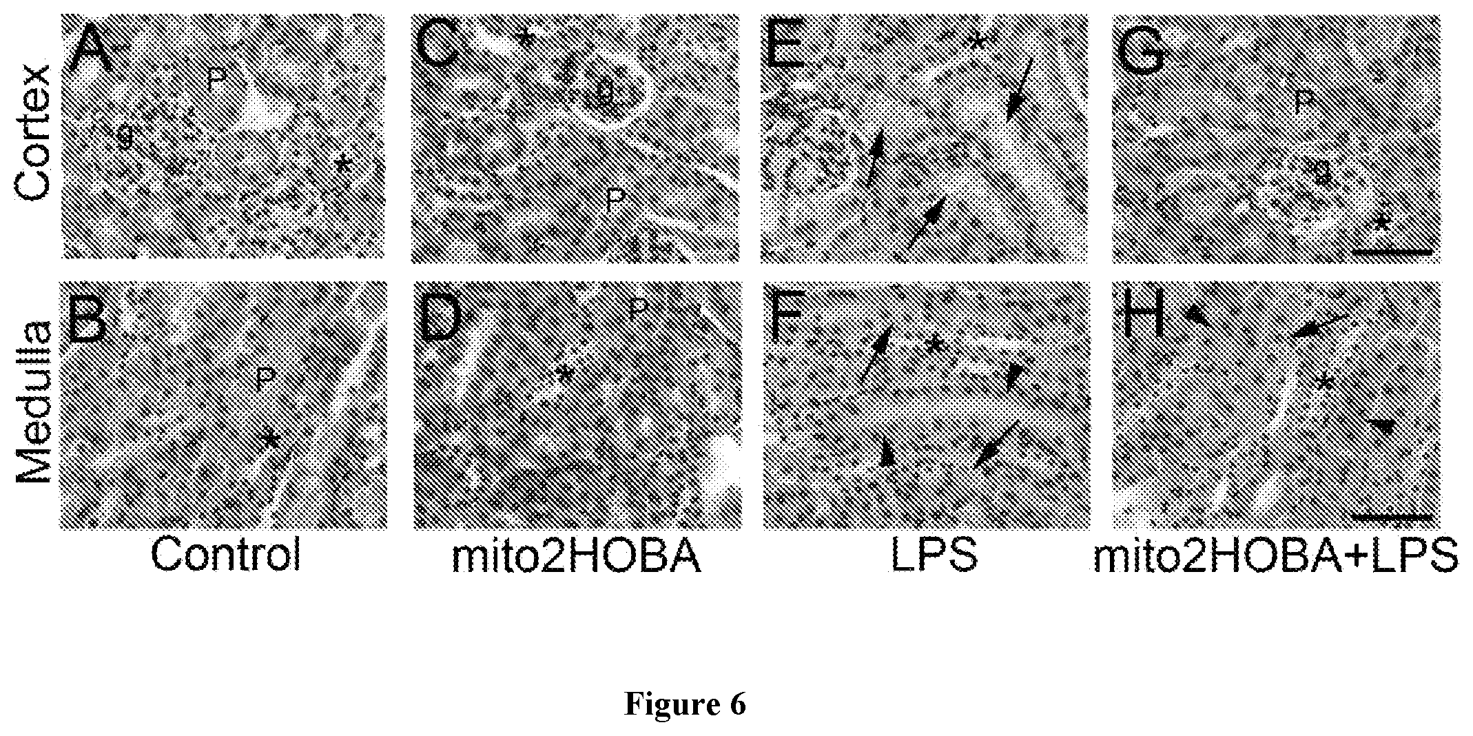 Patent US12564580 Figure 6 – Mitochondria-targeted isoketal/isolevuglandin scavengers and uses thereof