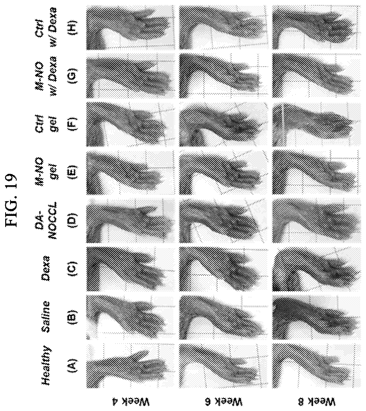 Patent US12564598 Figure 18 – Nitric oxide-sensitive hydrogel