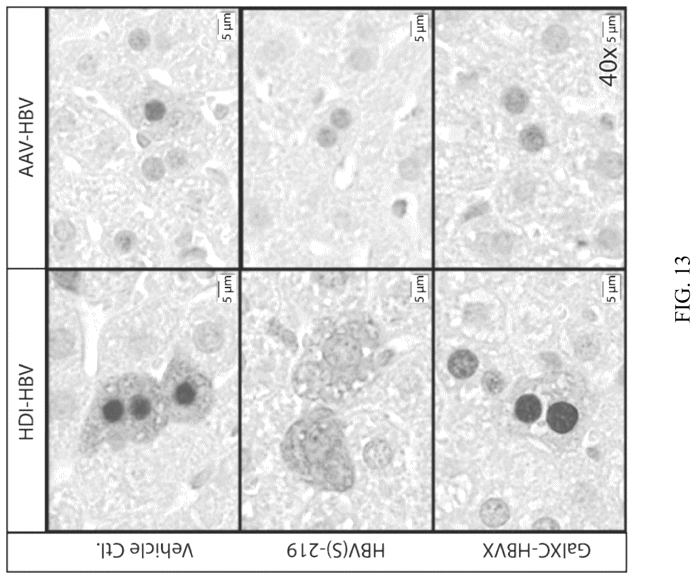Patent US12564601 Figure 11 – Methods for treating hepatitis B infection