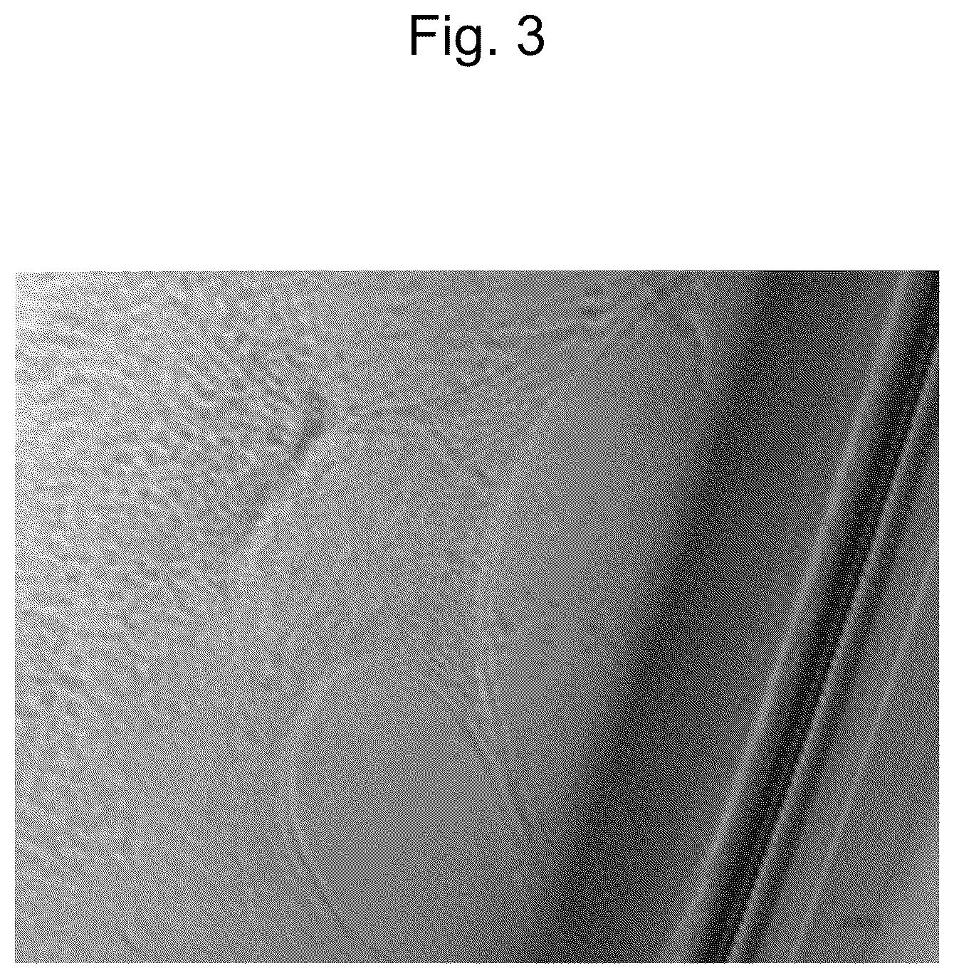 Patent US12564607 Figure 3 – Cell population comprising mesenchymal cells, pharmaceutical composition comprising the same, and method for producing the same