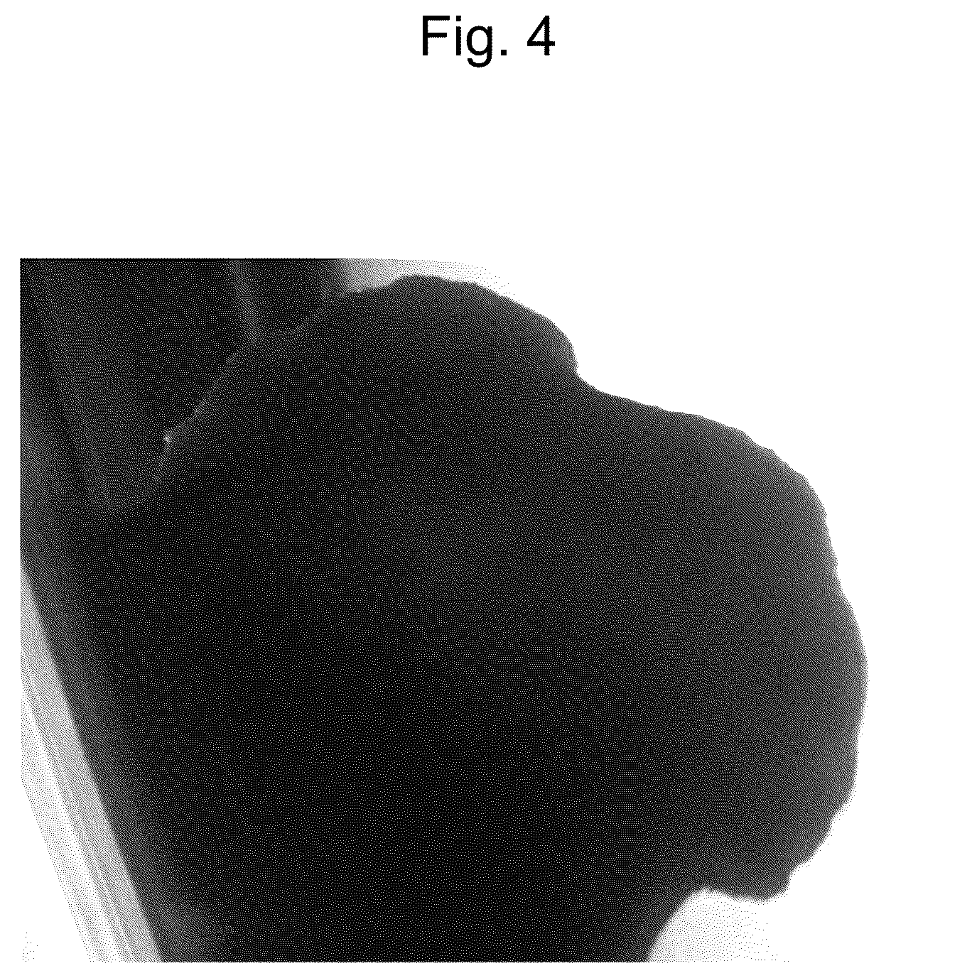 Patent US12564607 Figure 4 – Cell population comprising mesenchymal cells, pharmaceutical composition comprising the same, and method for producing the same