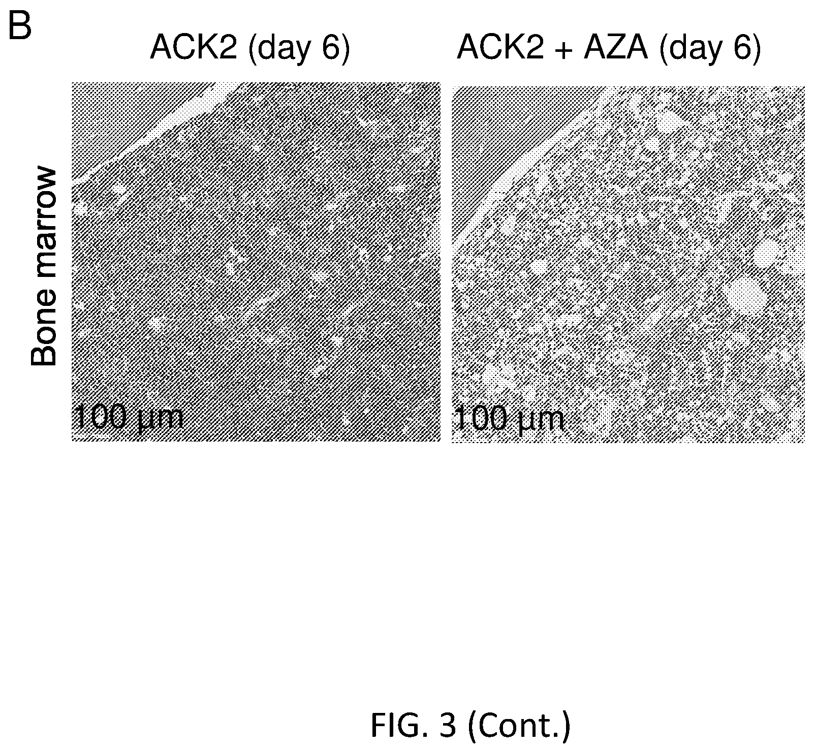 Patent US12564609 Figure 12 – Hematopoietic stem cell engraftment with a combination of agents