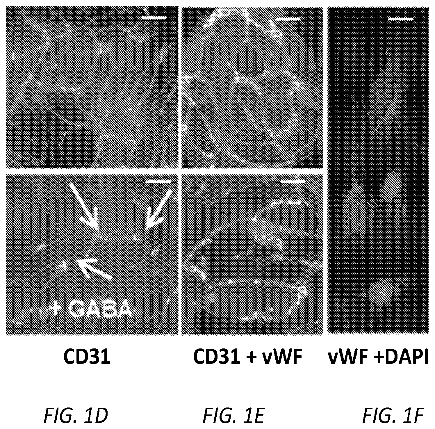 Patent US12564610 Figure 2 – Human periventricular endothelial cell therapy for neuropsychiatric disorders