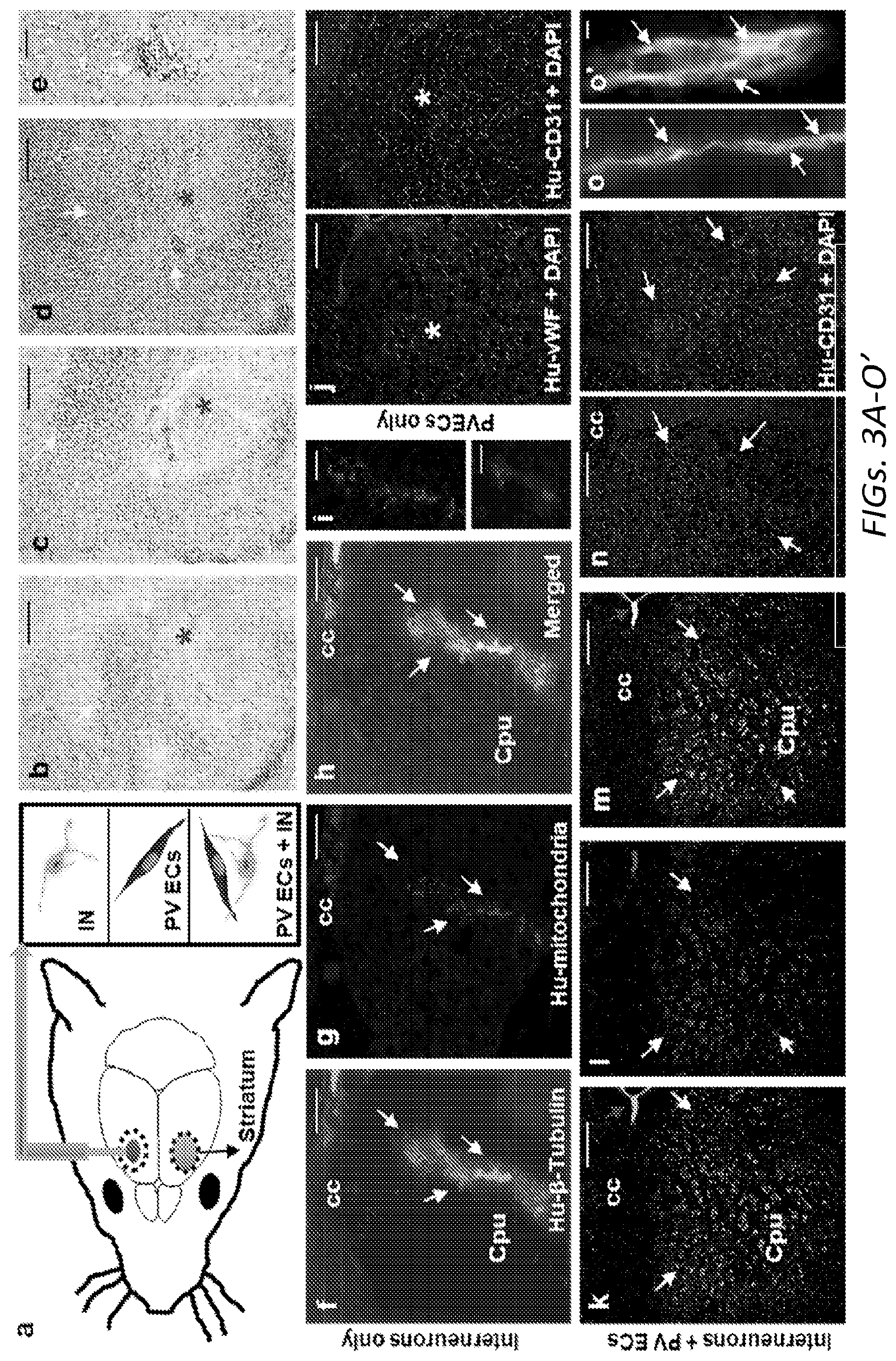 Patent US12564610 Figure 9 – Human periventricular endothelial cell therapy for neuropsychiatric disorders