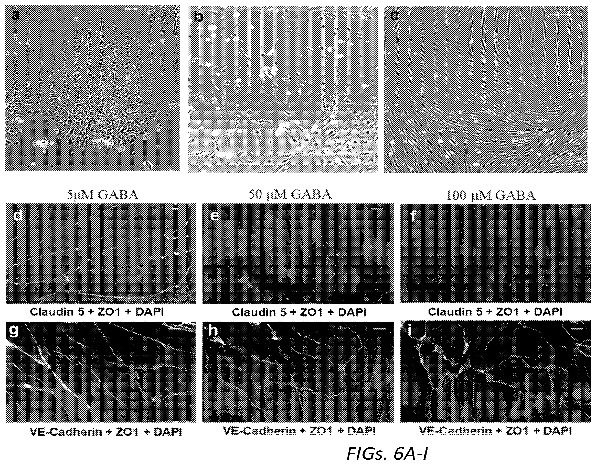 Patent US12564610 Figure 15 – Human periventricular endothelial cell therapy for neuropsychiatric disorders
