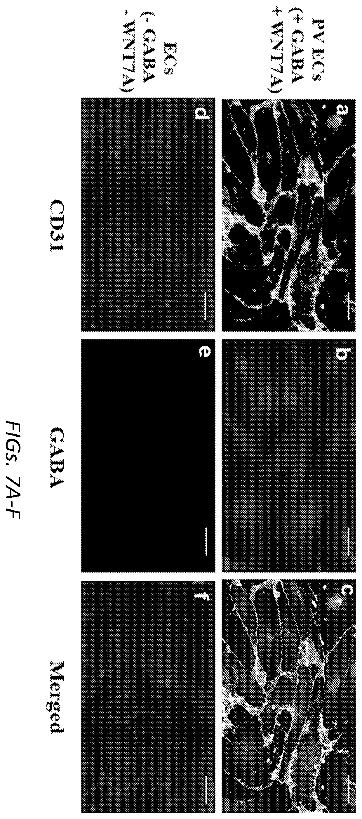 Patent US12564610 Figure 16 – Human periventricular endothelial cell therapy for neuropsychiatric disorders