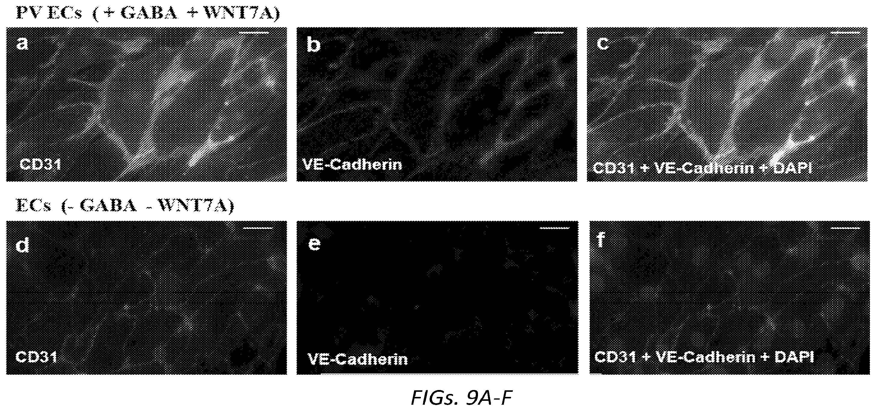 Patent US12564610 Figure 19 – Human periventricular endothelial cell therapy for neuropsychiatric disorders