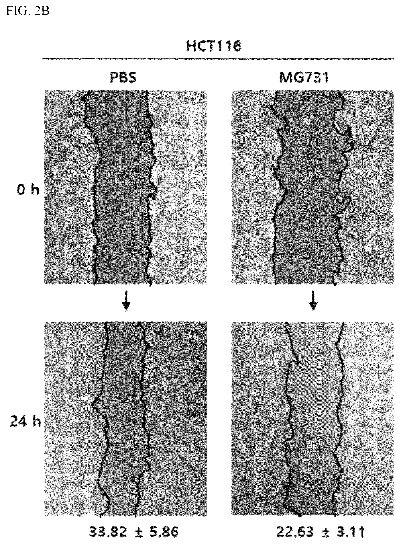 Patent US12564613 Figure 3 – Strains having effects of preventing or treating cancers