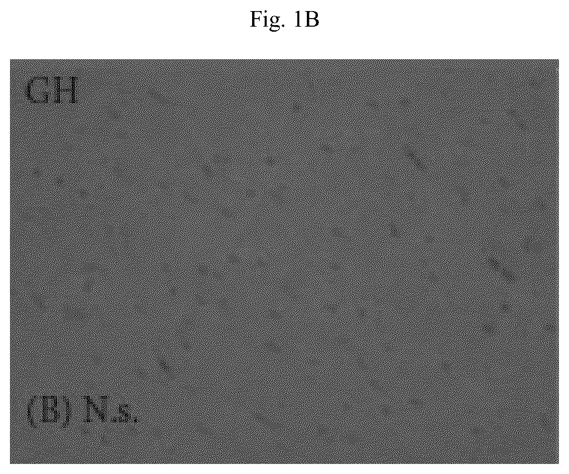 Patent US12564615 Figure 2 – Treatment method for cardiac hypertrophy