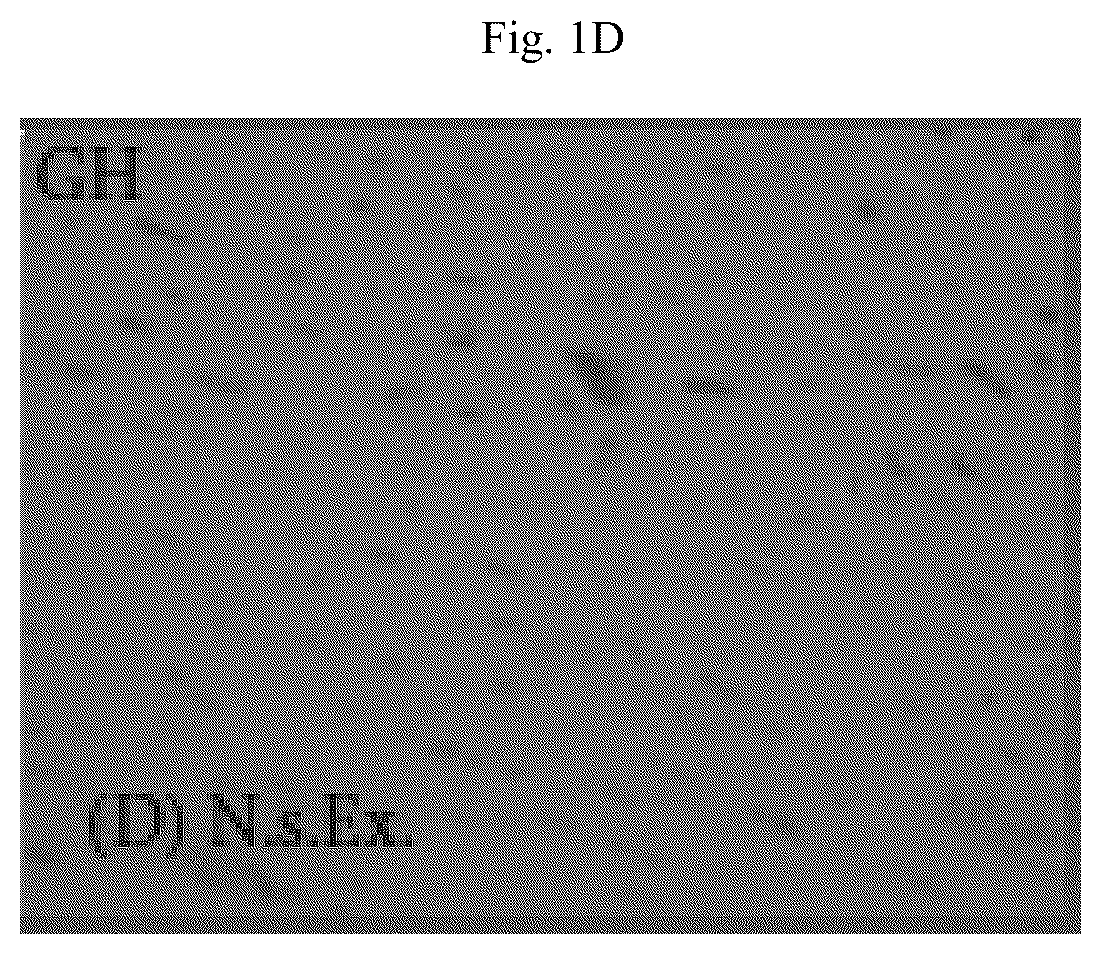 Patent US12564615 Figure 4 – Treatment method for cardiac hypertrophy