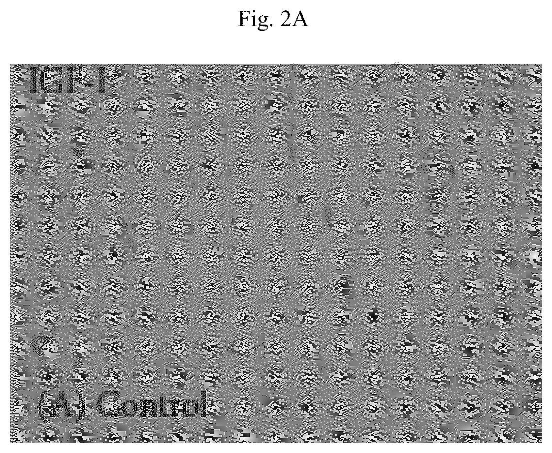 Patent US12564615 Figure 5 – Treatment method for cardiac hypertrophy